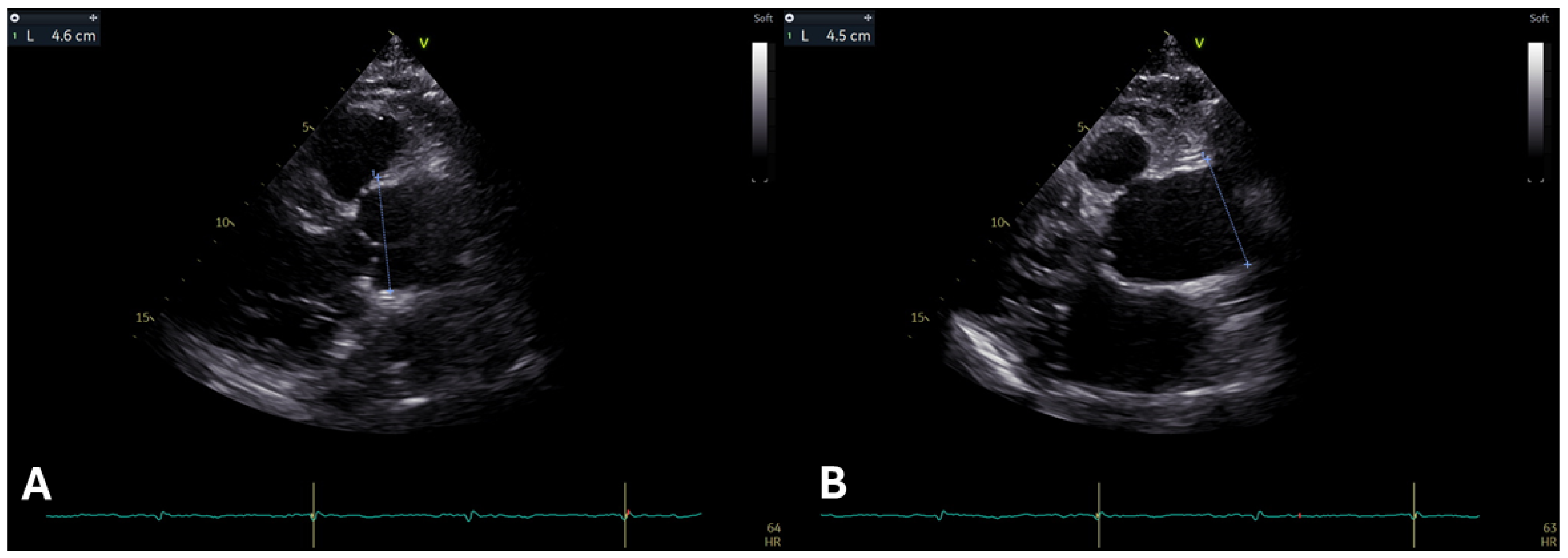 Diagnostics 15 00172 g001 Diagnostics 15 00172 g001