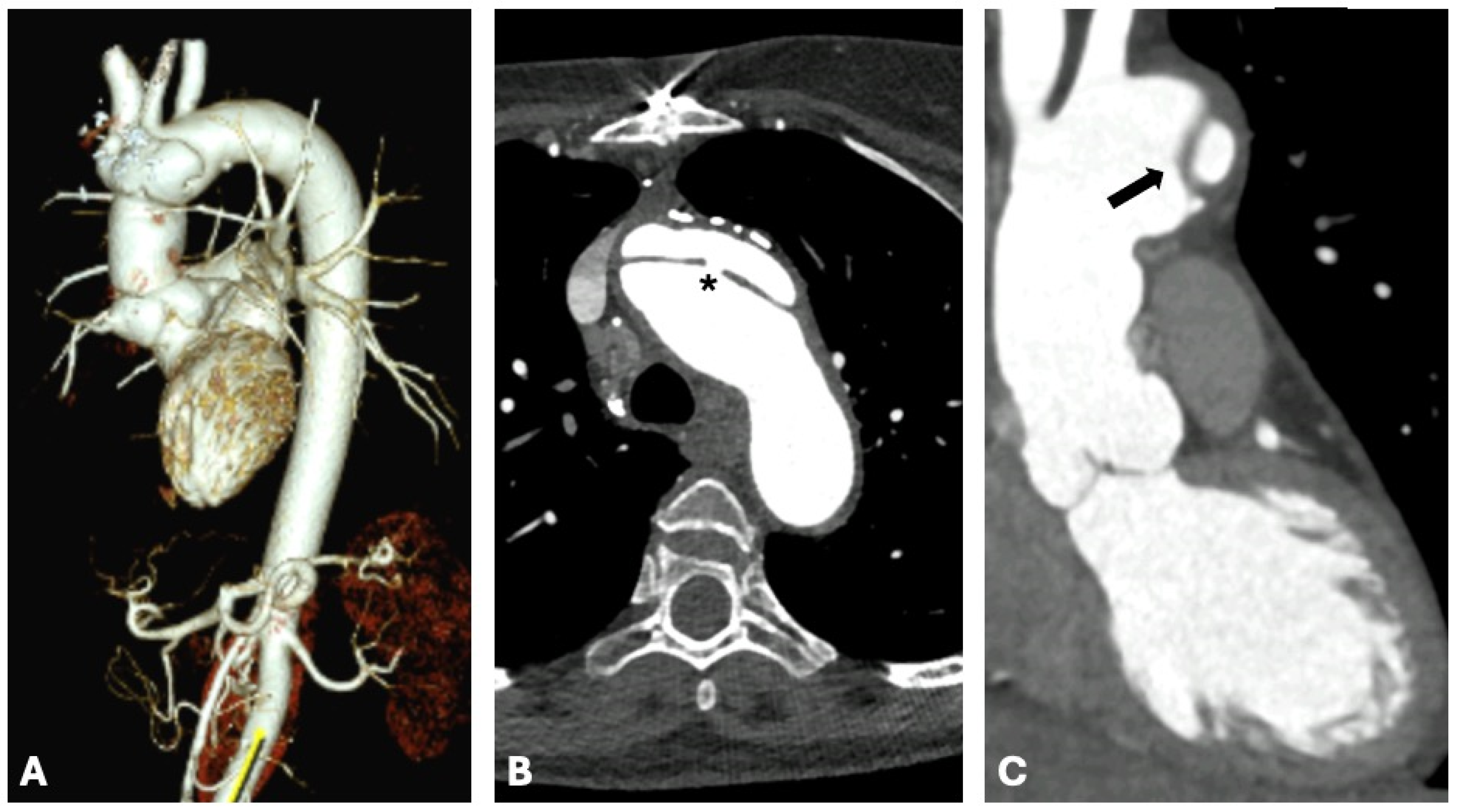 Diagnostics 15 00172 g005 Diagnostics 15 00172 g005