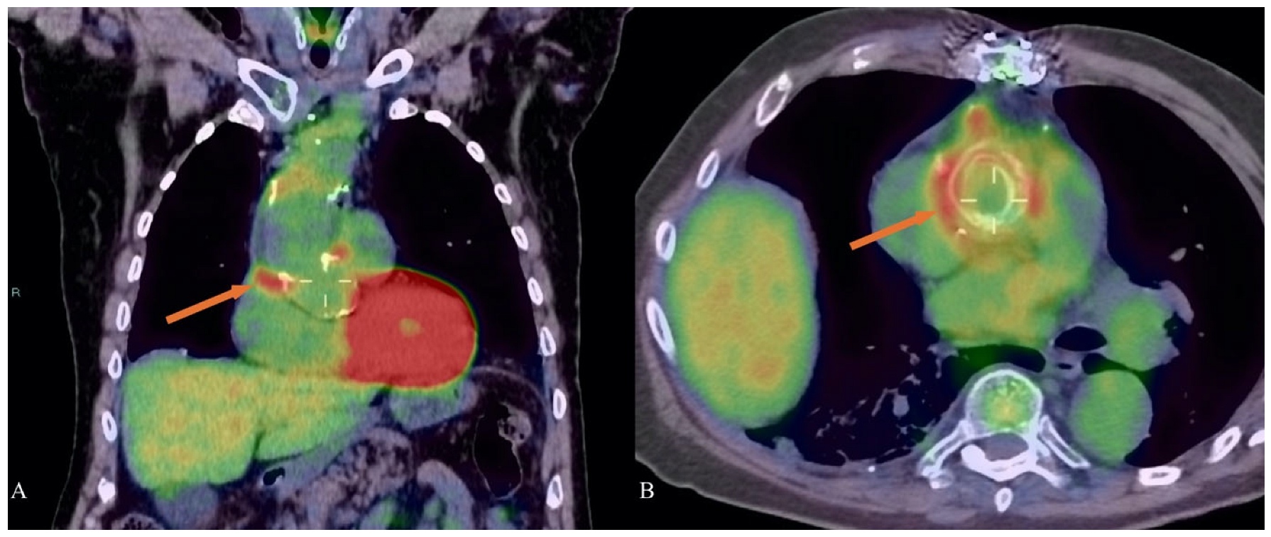 Diagnostics 15 00172 g006 Diagnostics 15 00172 g006
