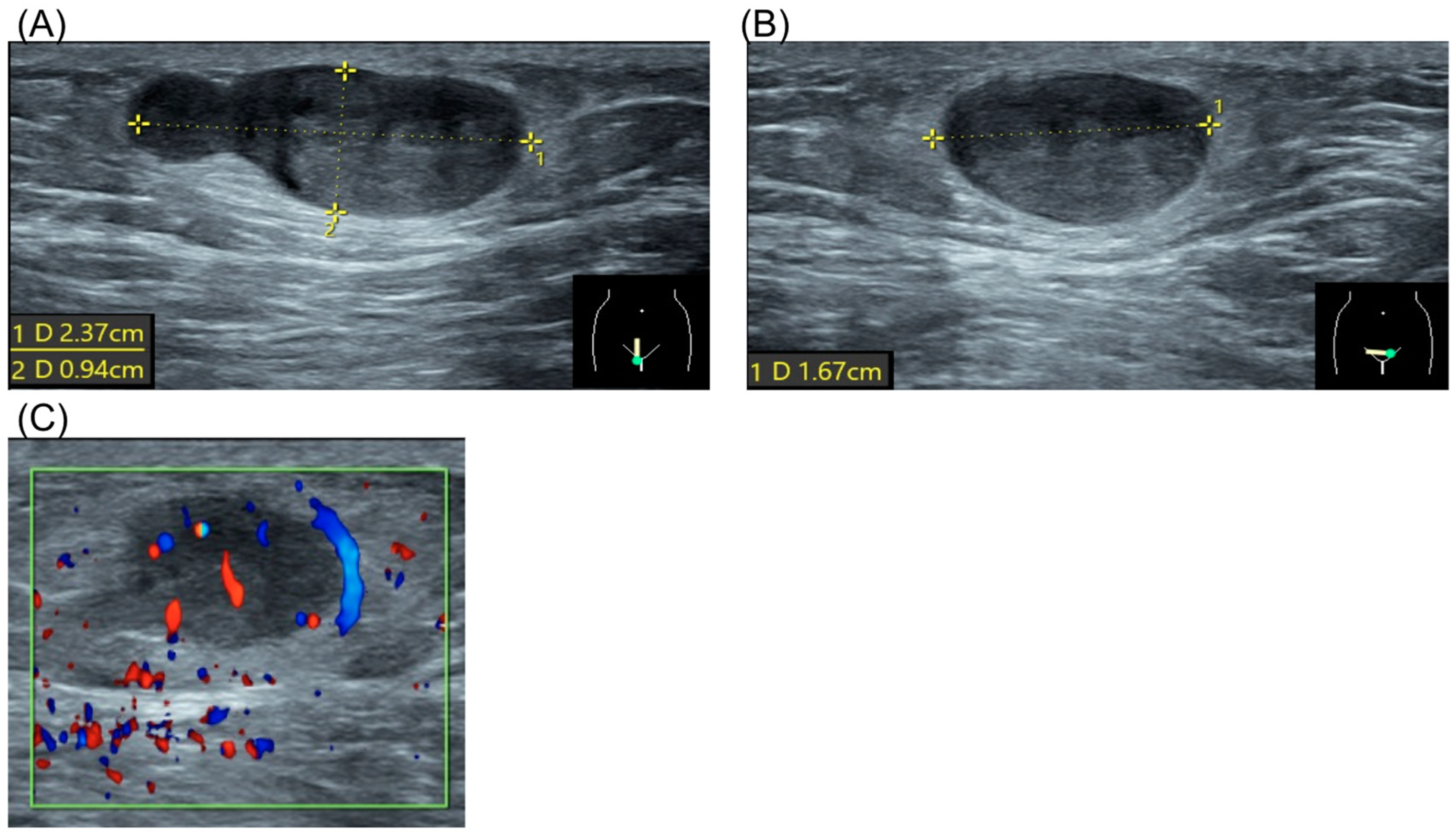 Diagnostics 15 00173 g001