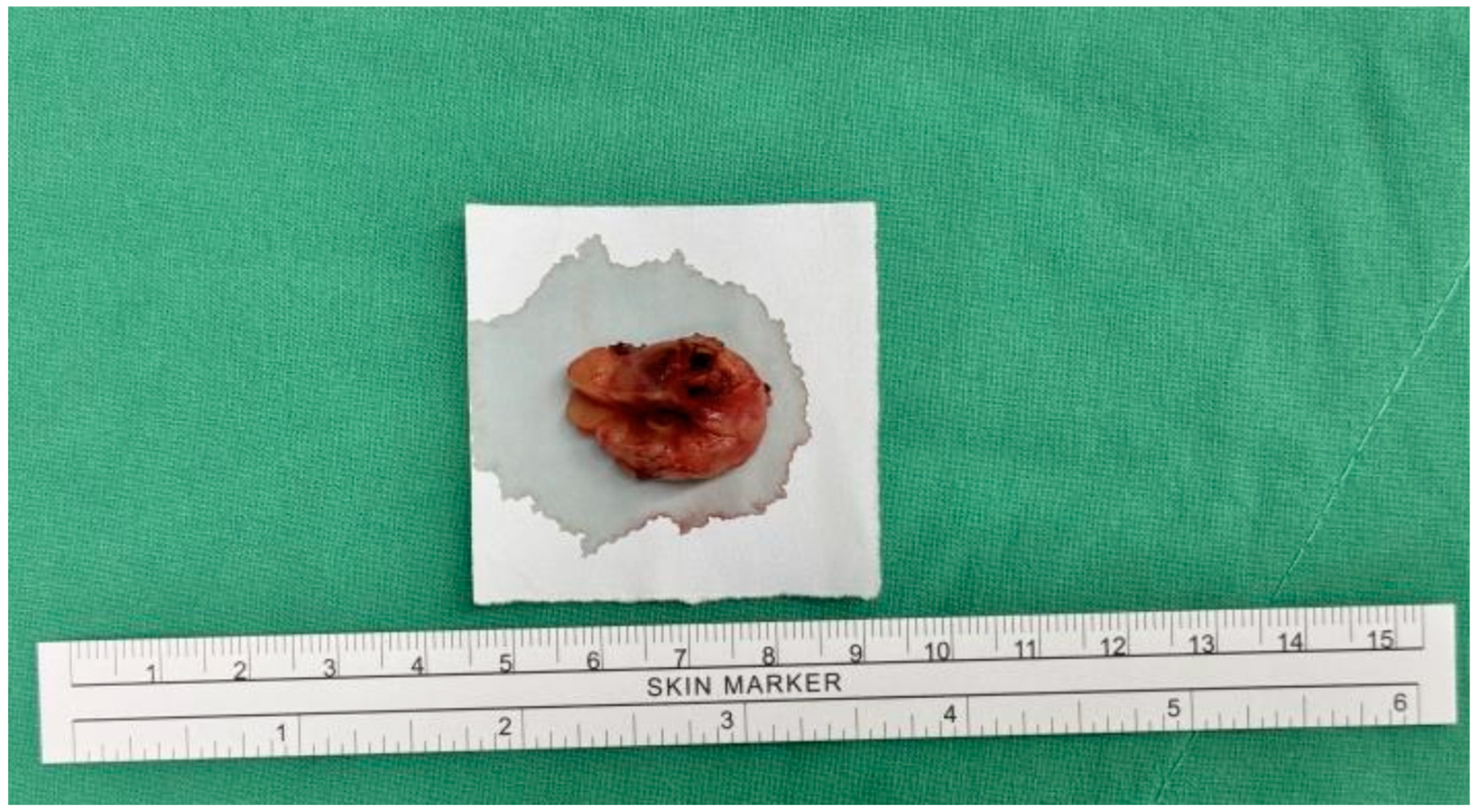 Diagnostics 15 00173 g002