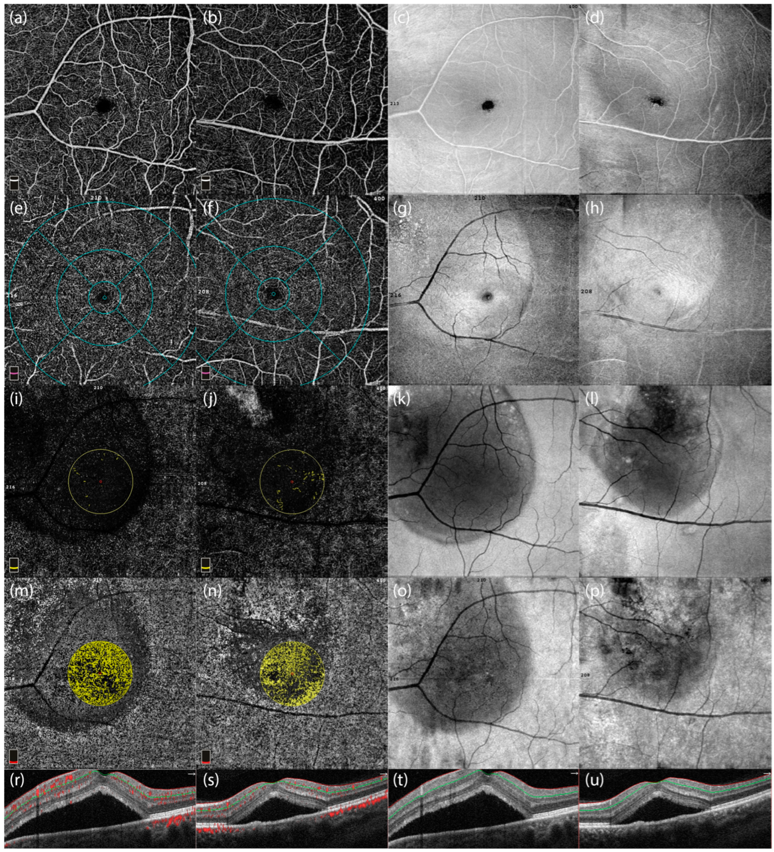 Diagnostics 15 00174 g004 Diagnostics 15 00174 g004