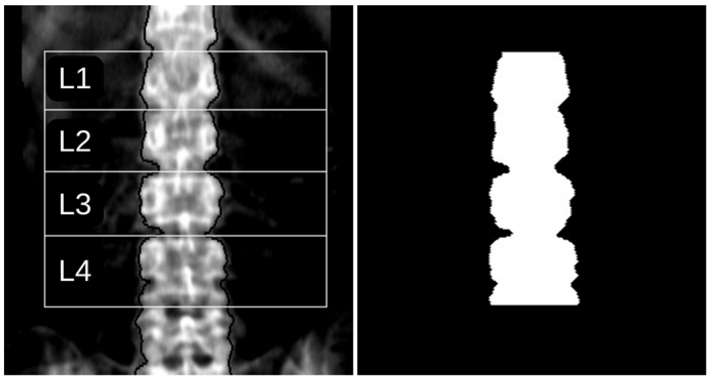 Diagnostics 15 00175 g001