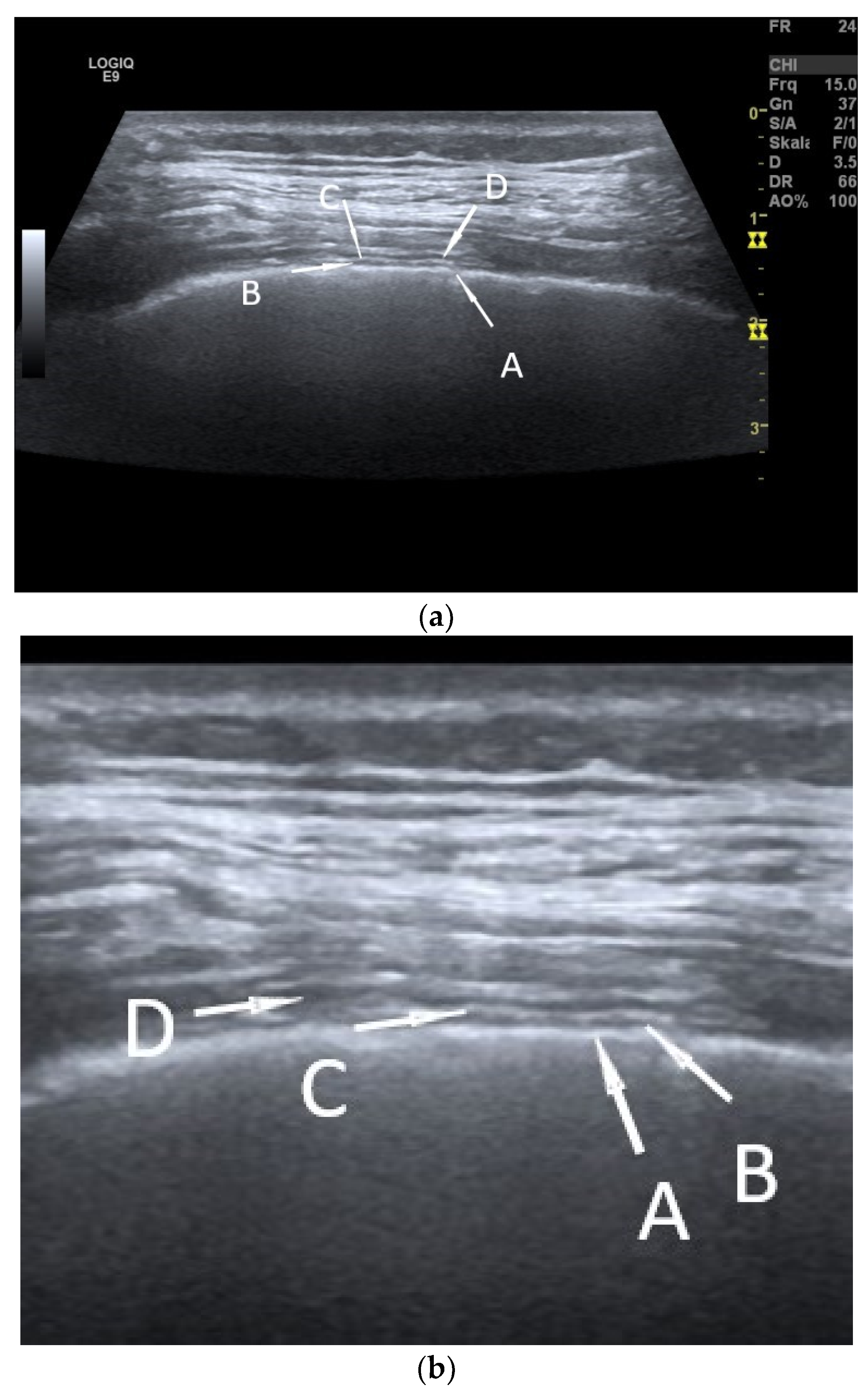 Diagnostics 15 00176 g001