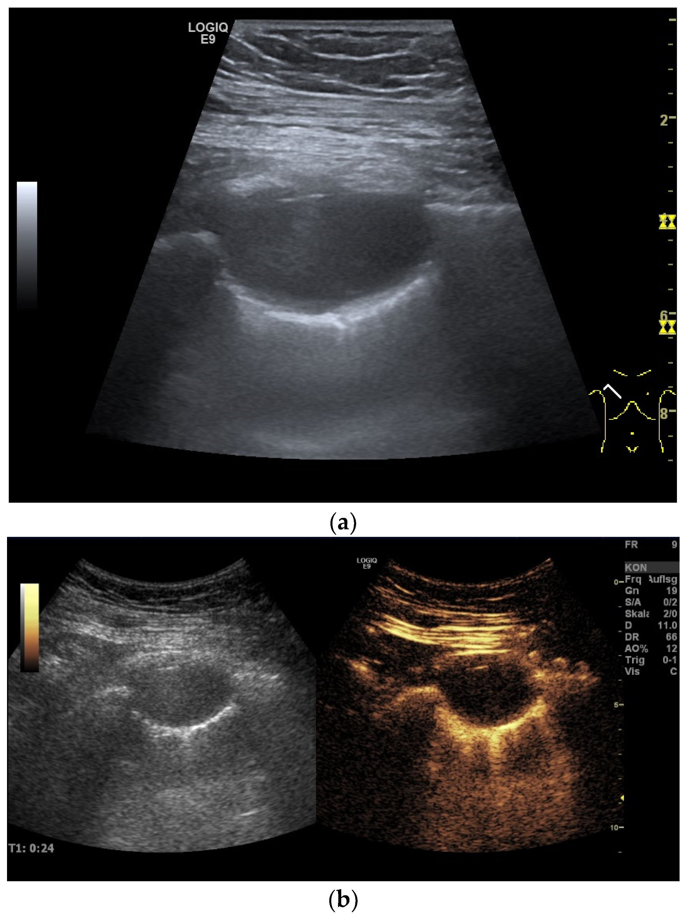Diagnostics 15 00176 g002