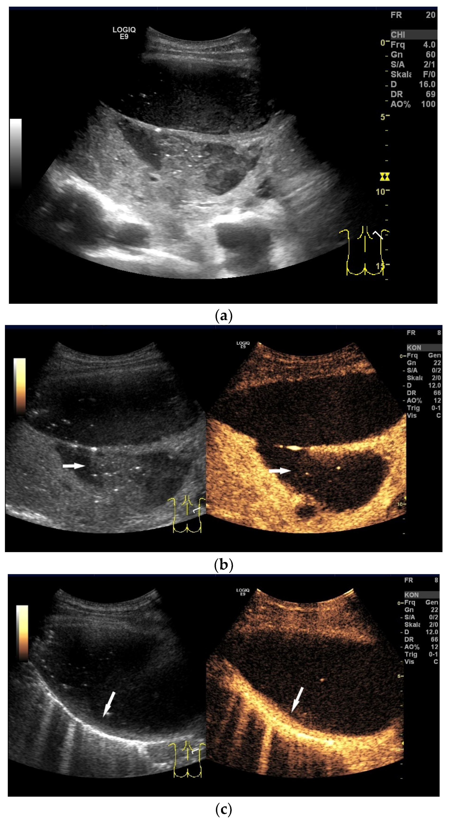 Diagnostics 15 00176 g003
