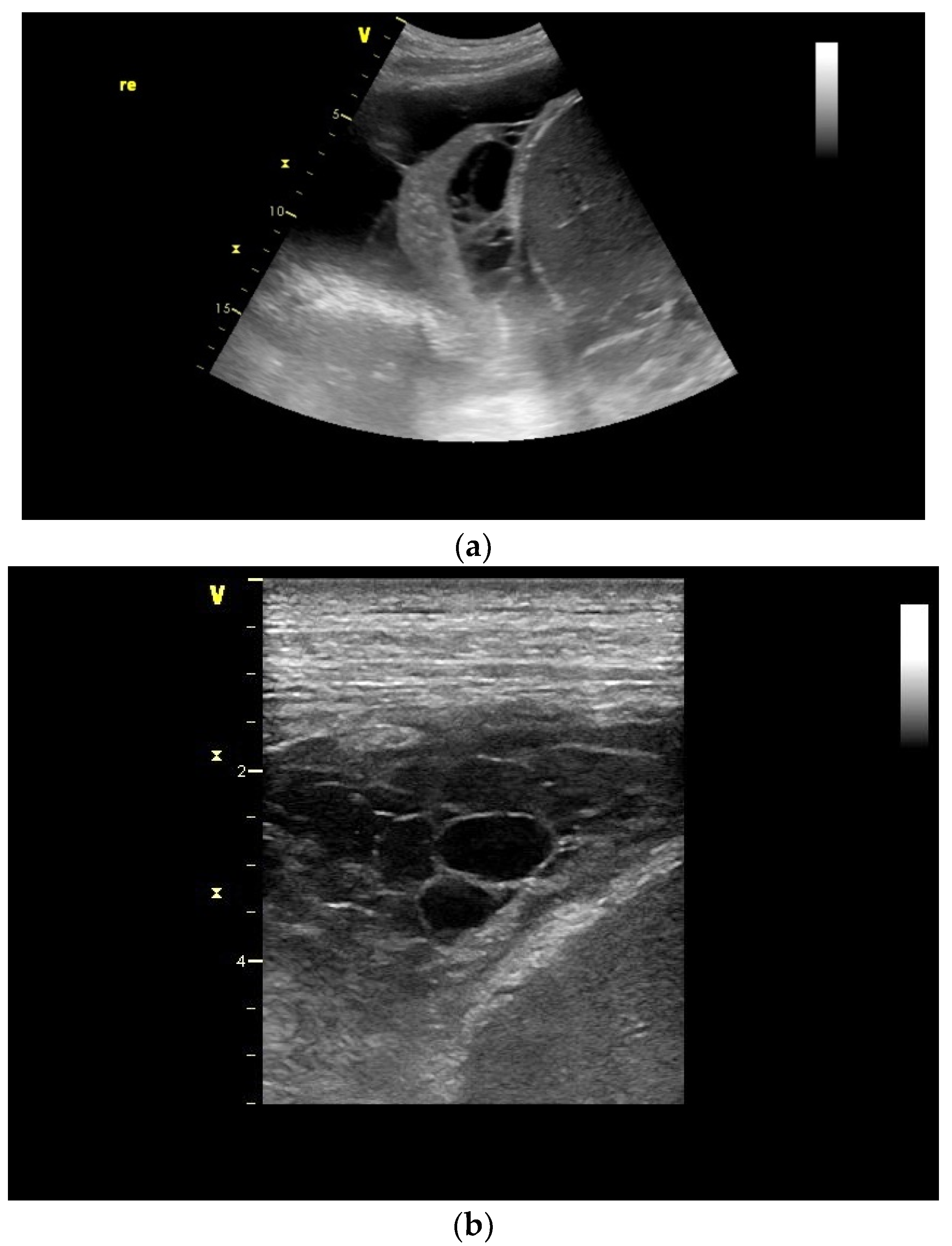 Diagnostics 15 00176 g004