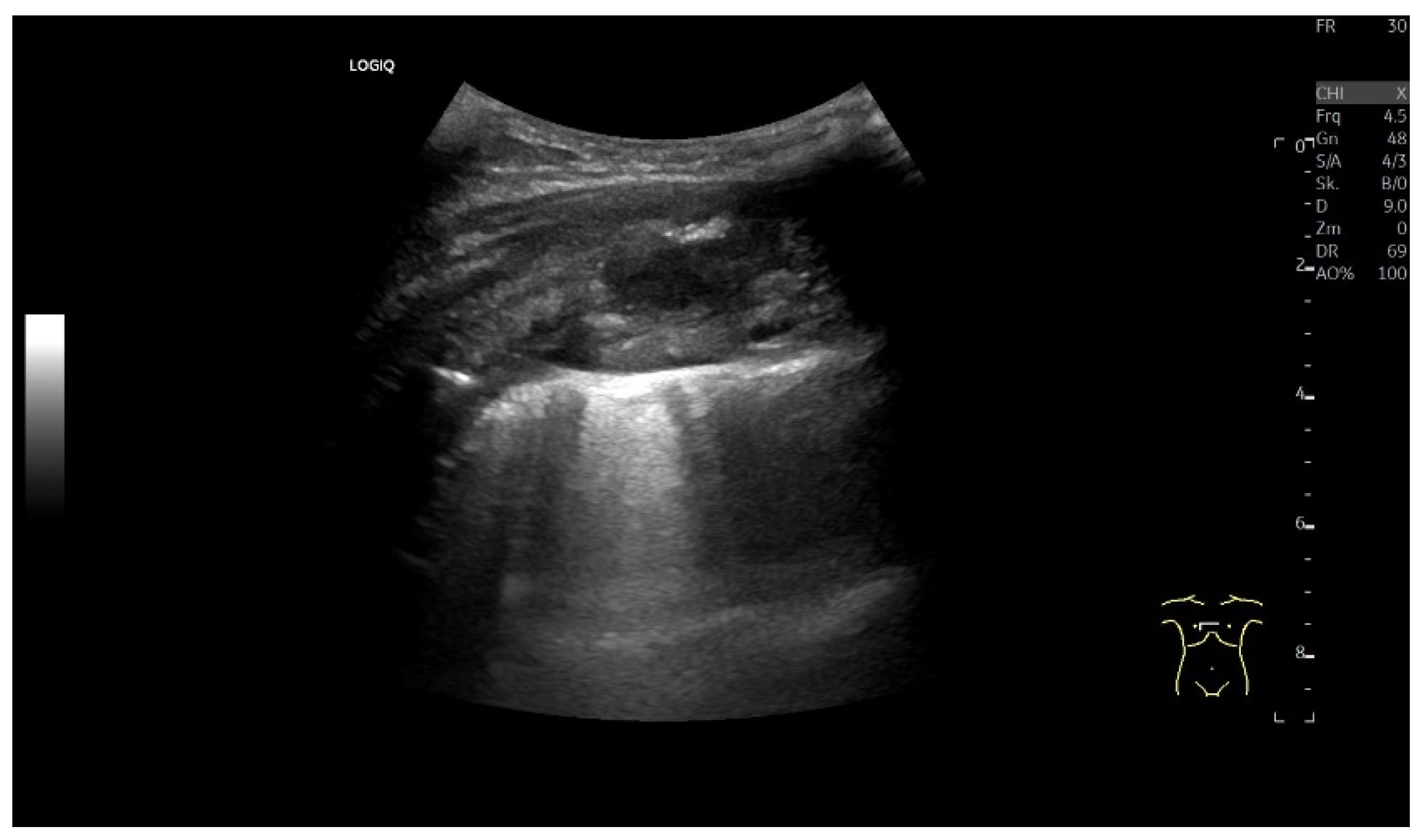 Diagnostics 15 00176 g005