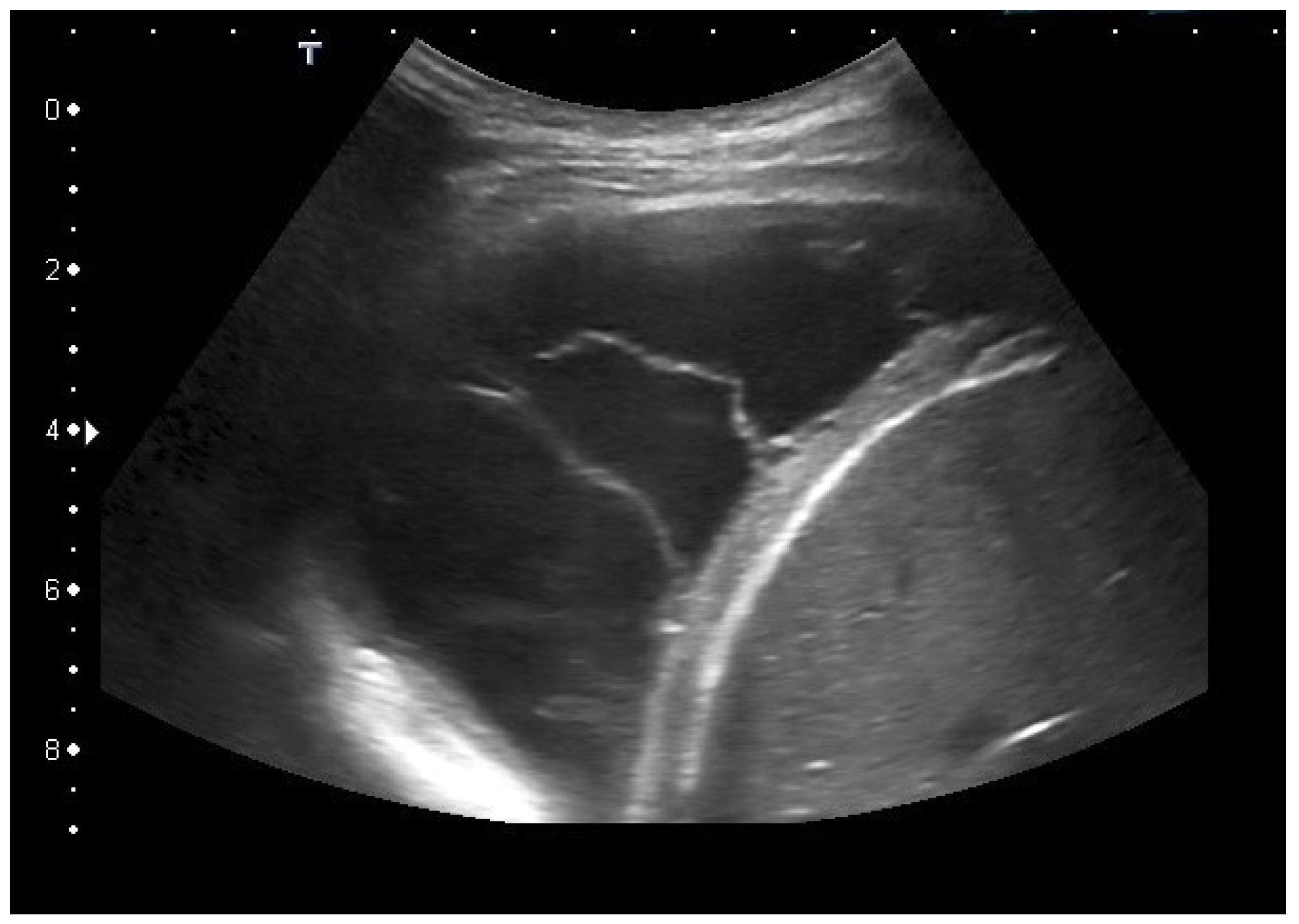 Diagnostics 15 00176 g006