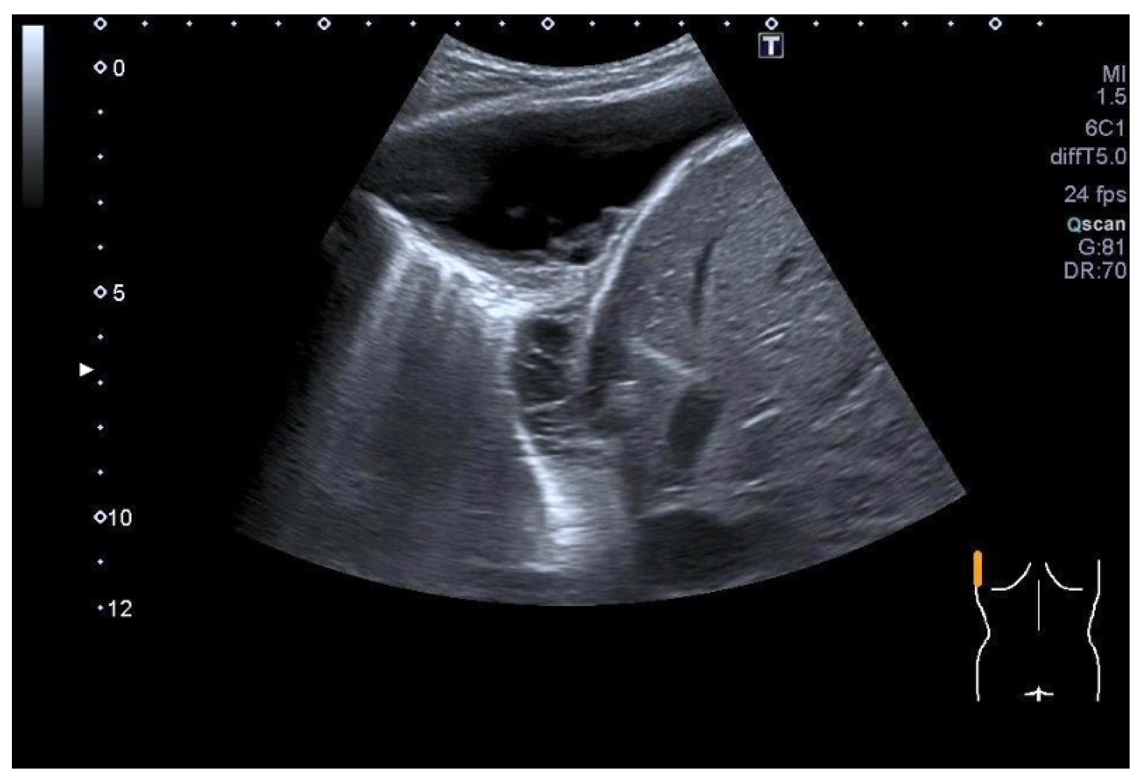 Diagnostics 15 00176 g007