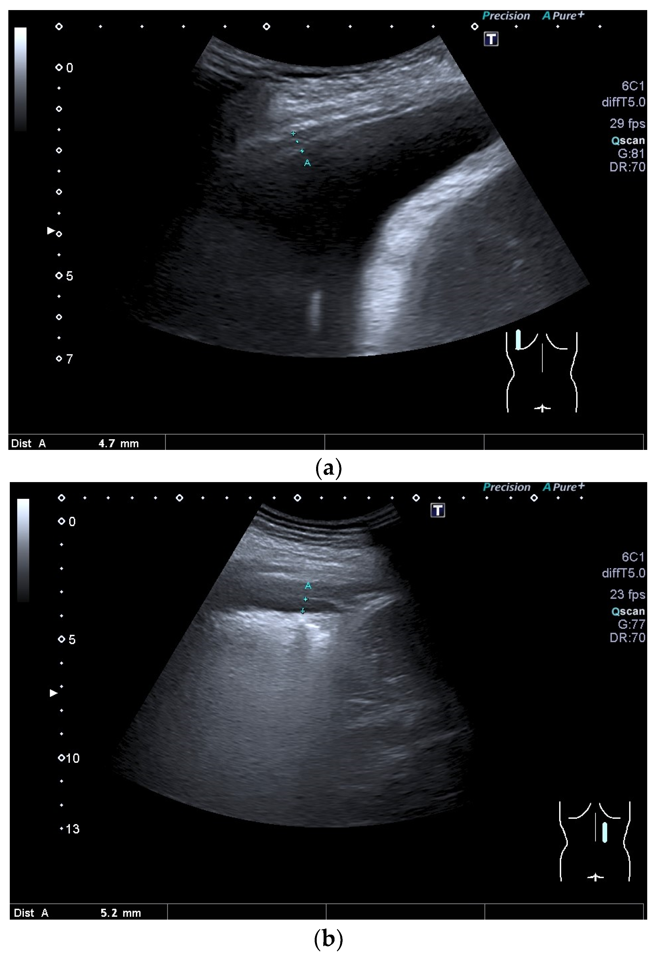 Diagnostics 15 00176 g010