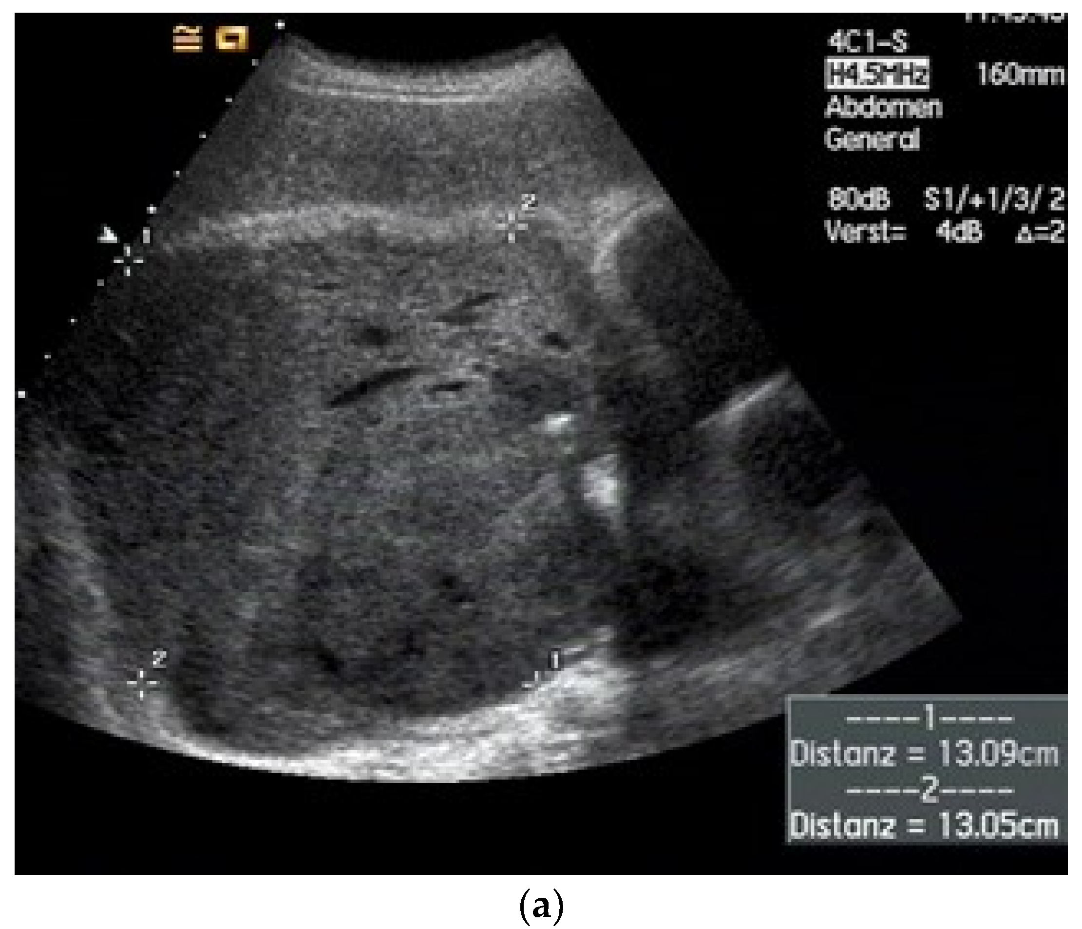 Diagnostics 15 00176 g012a