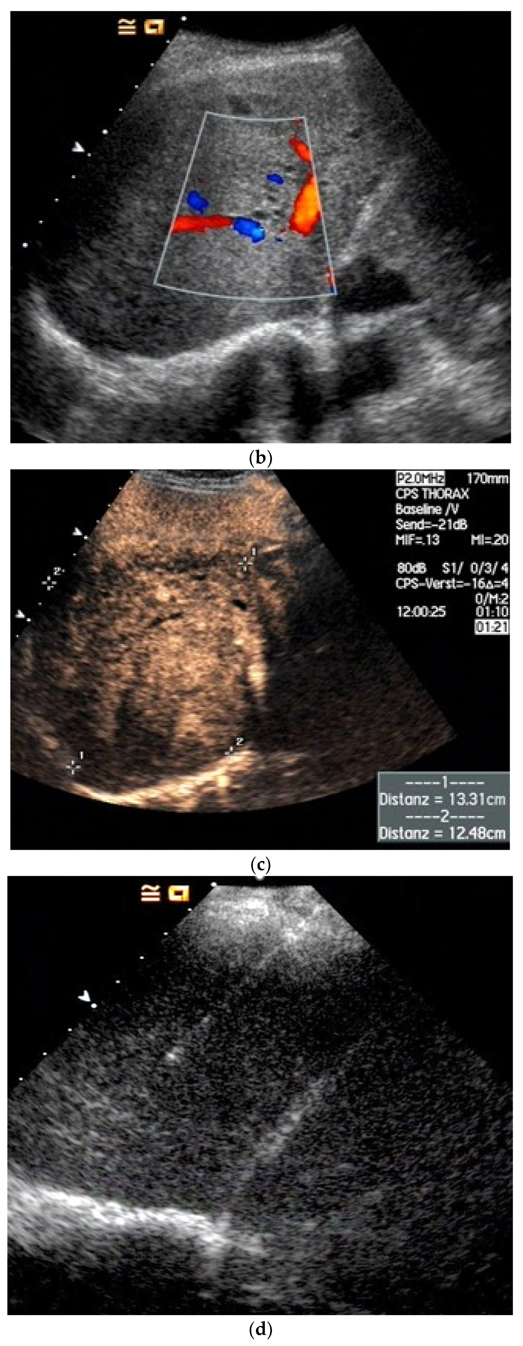 Diagnostics 15 00176 g012b
