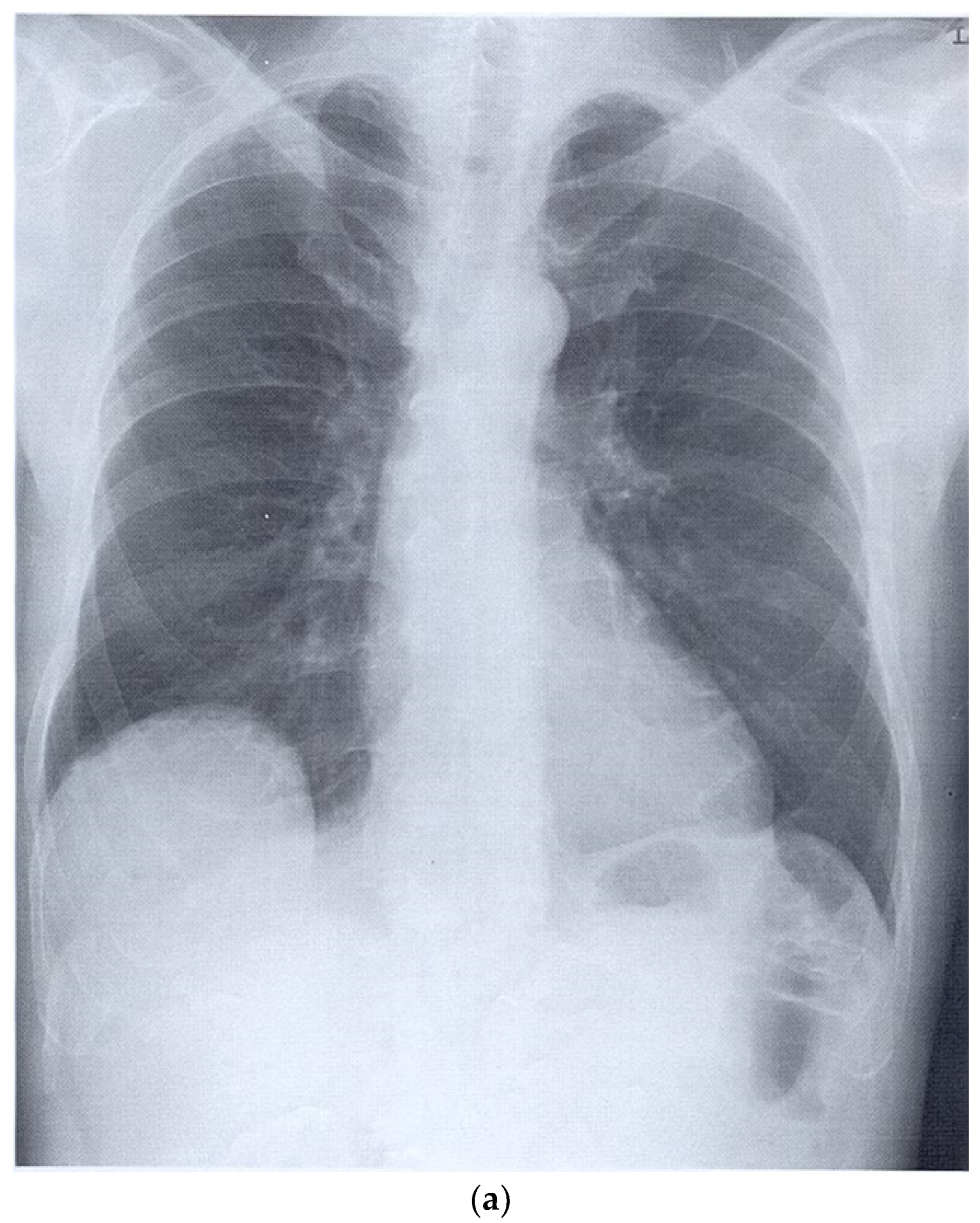 Diagnostics 15 00176 g013a