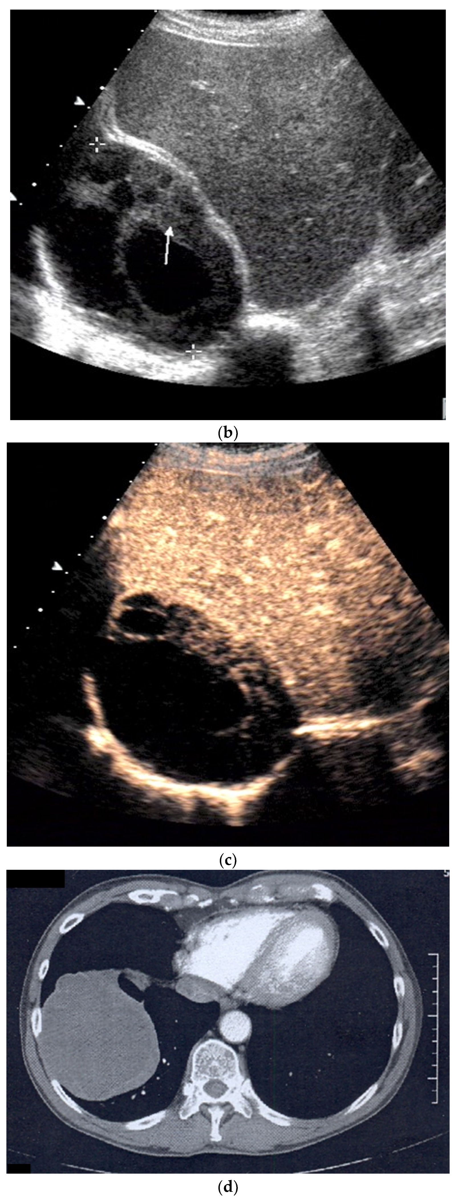 Diagnostics 15 00176 g013b
