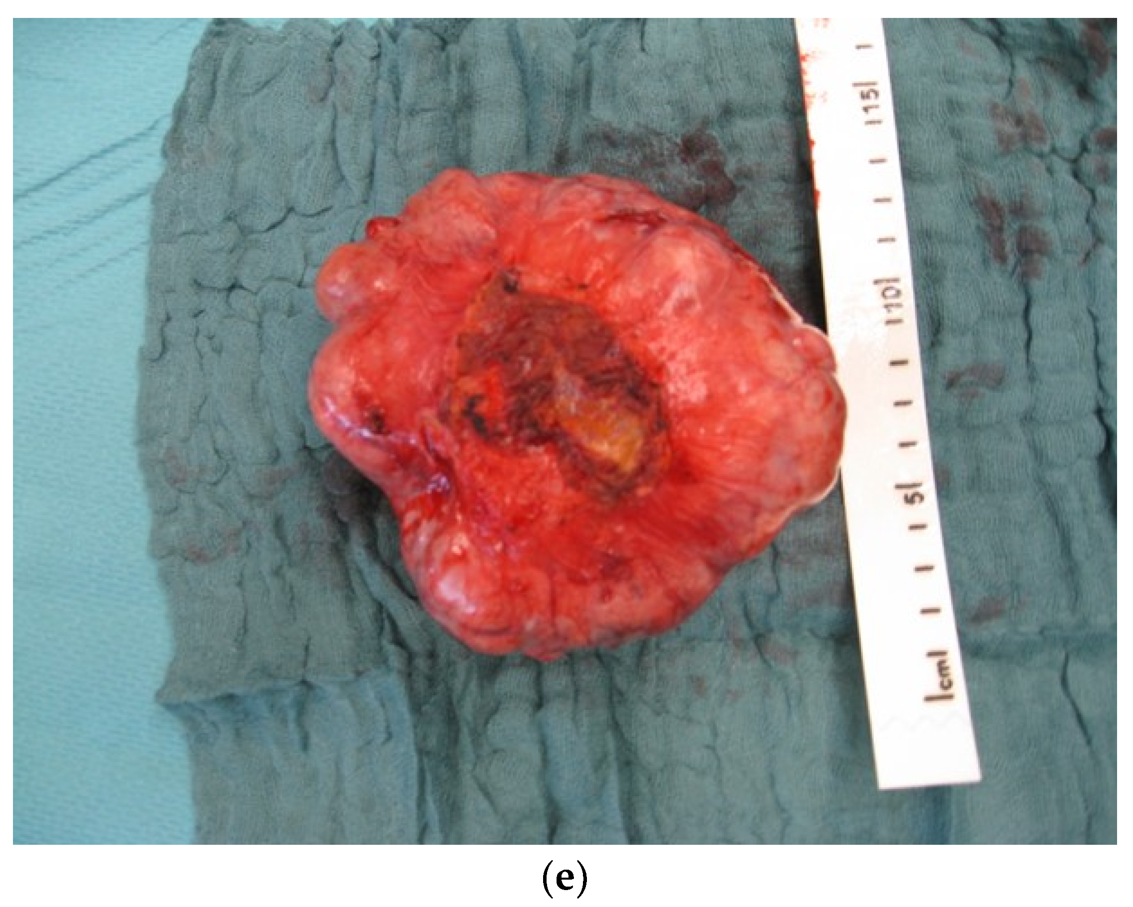 Diagnostics 15 00176 g013c