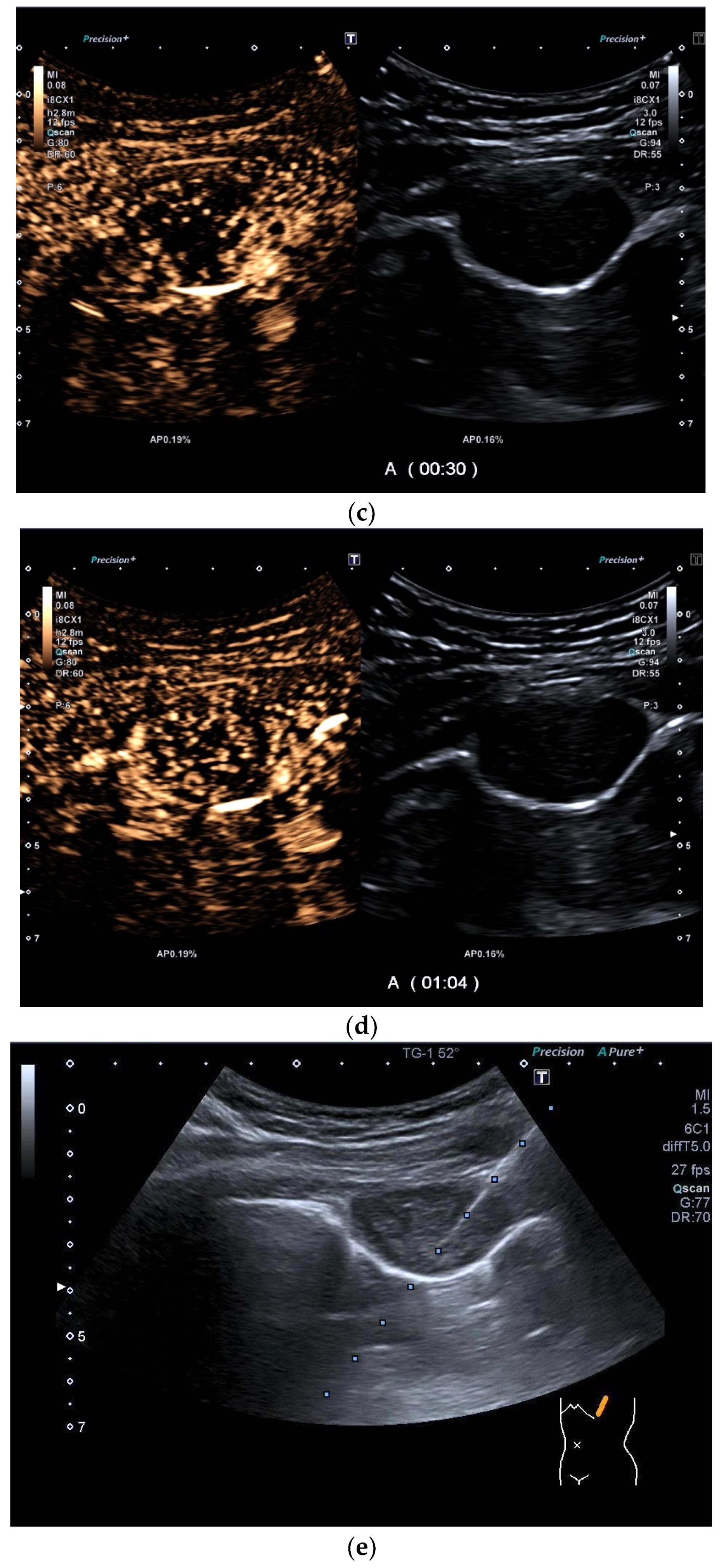 Diagnostics 15 00176 g014b