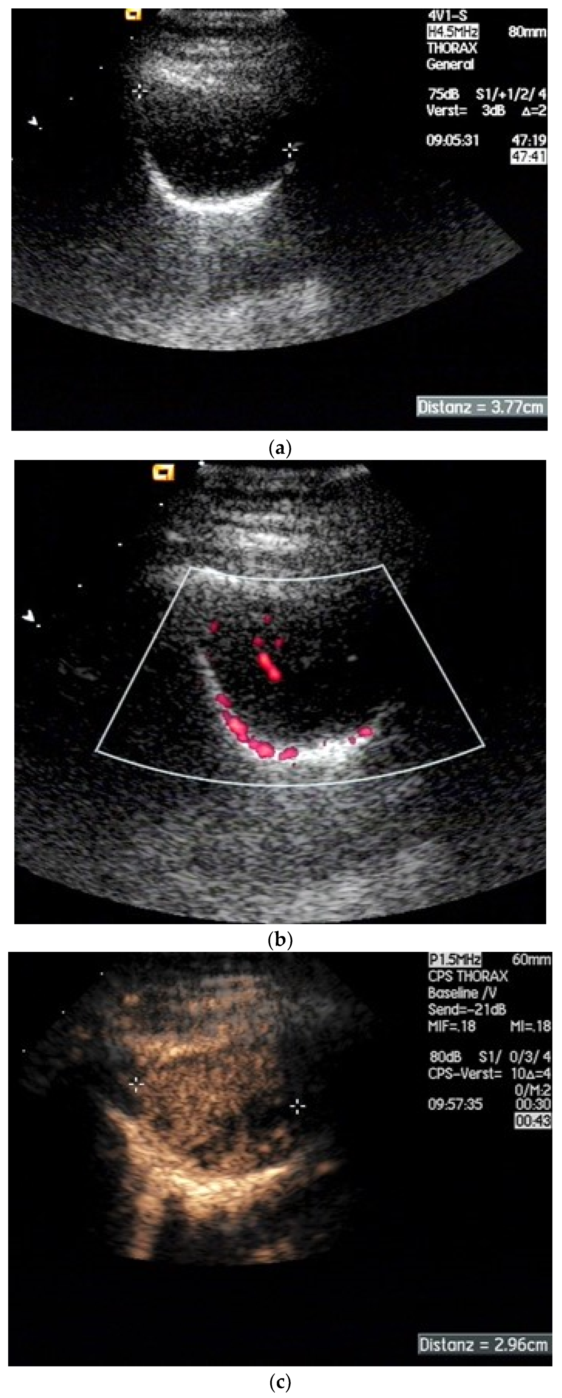 Diagnostics 15 00176 g015