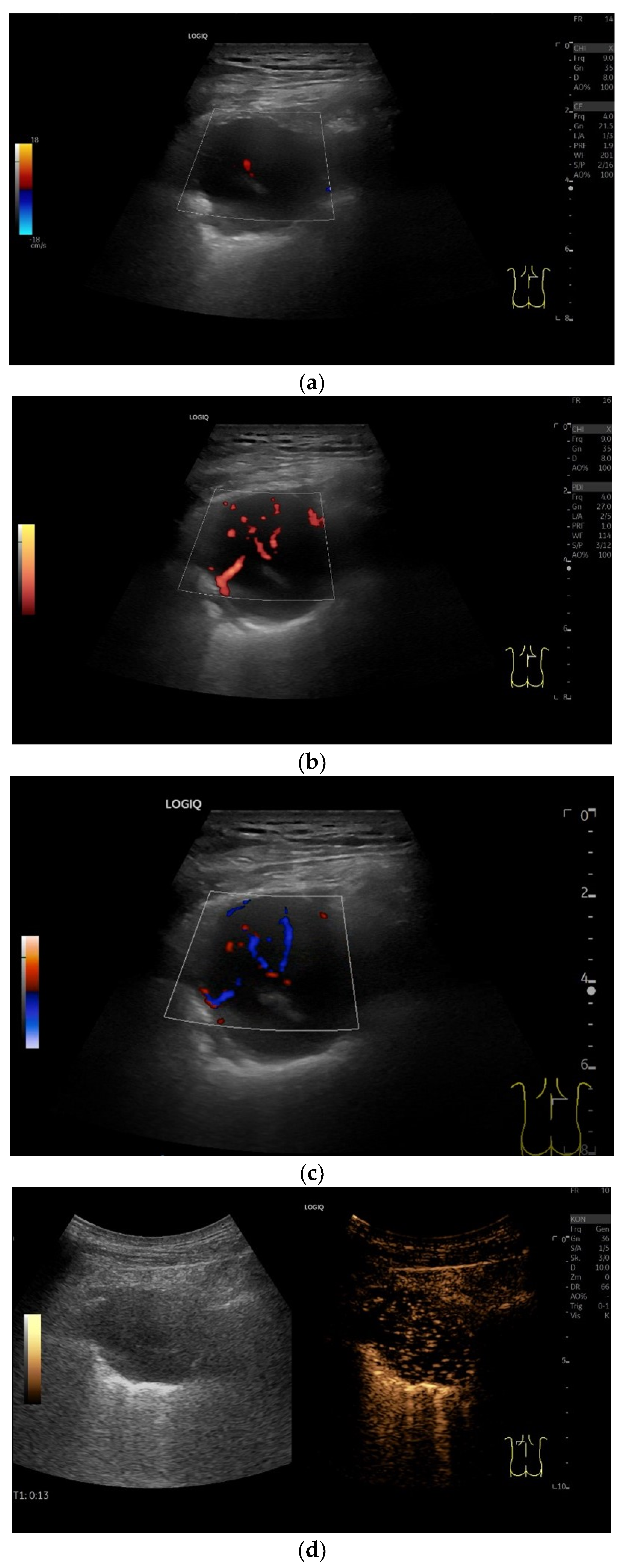 Diagnostics 15 00176 g016a