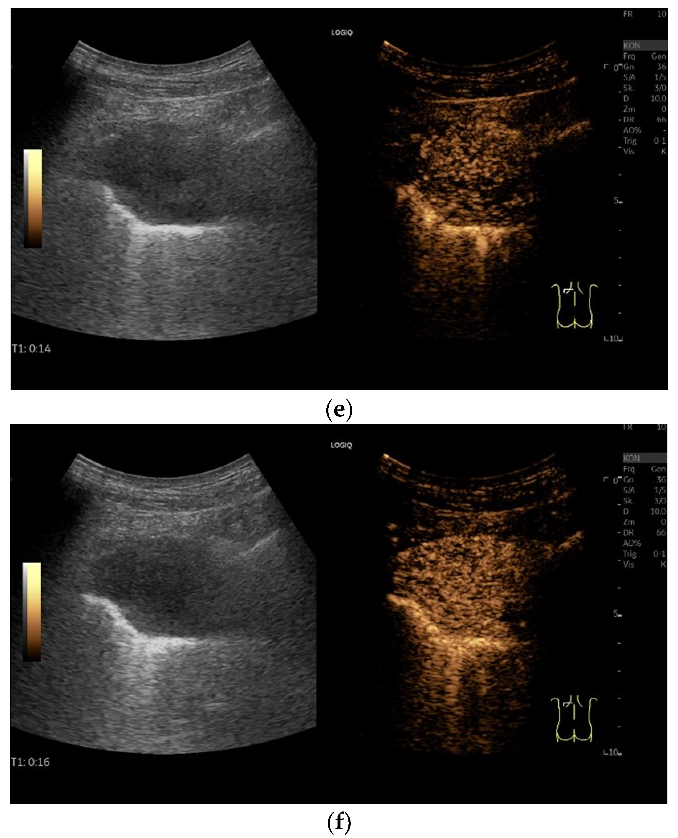 Diagnostics 15 00176 g016b