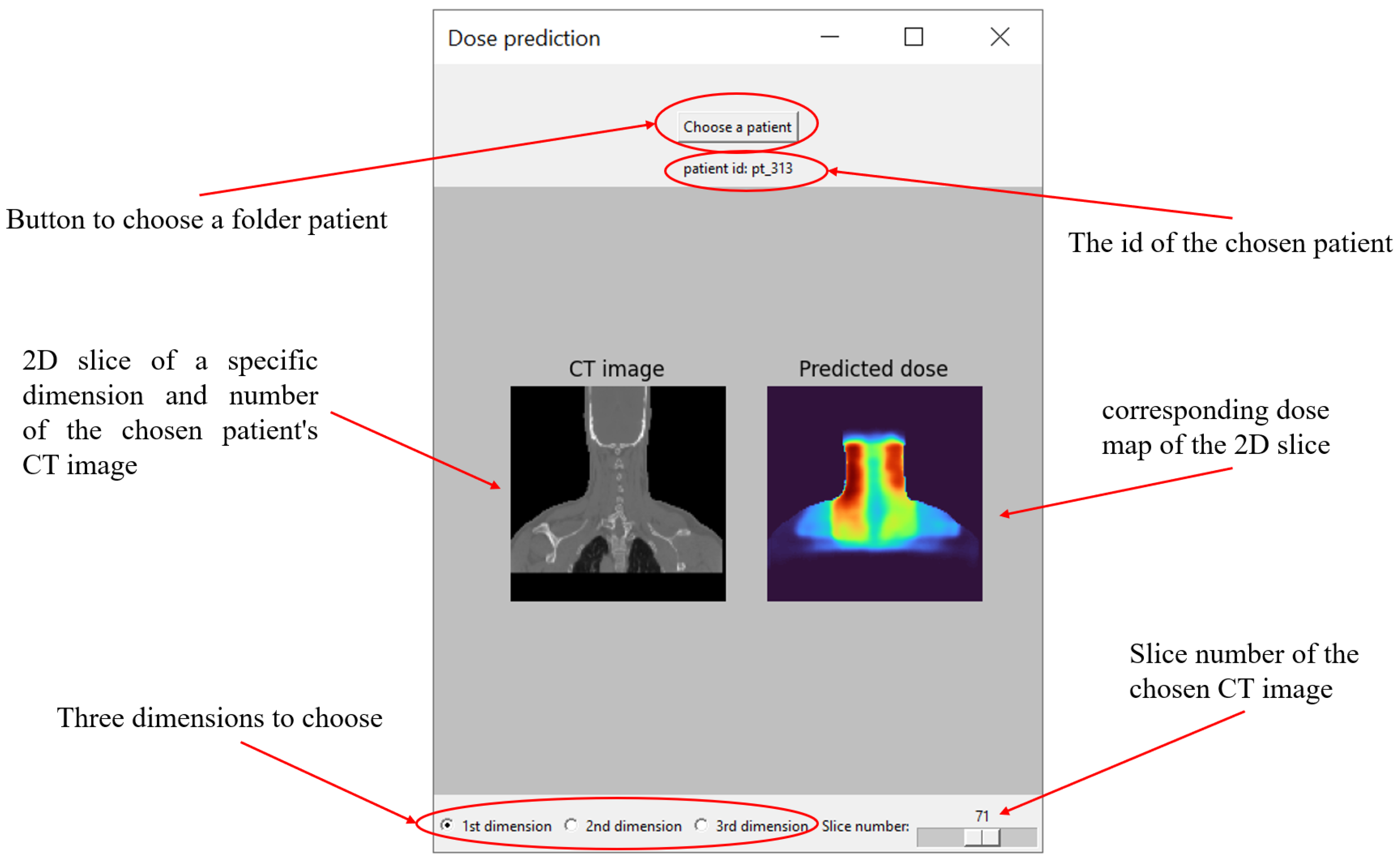 Diagnostics 15 00177 g012 Diagnostics 15 00177 g012