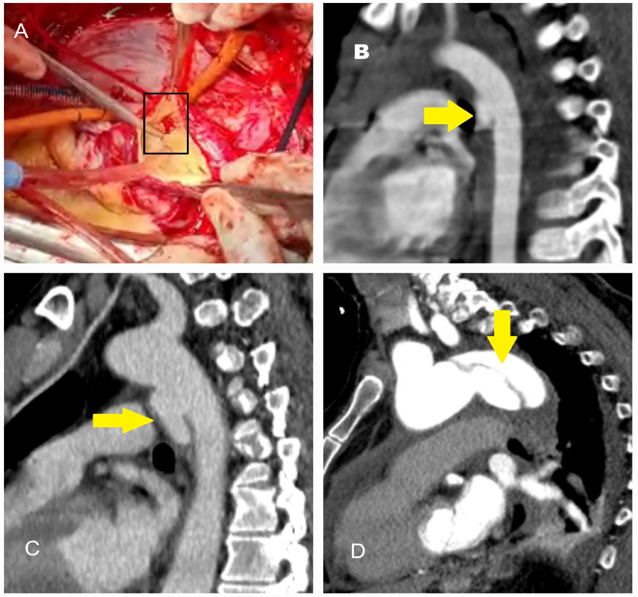 Diagnostics 15 00183 g001