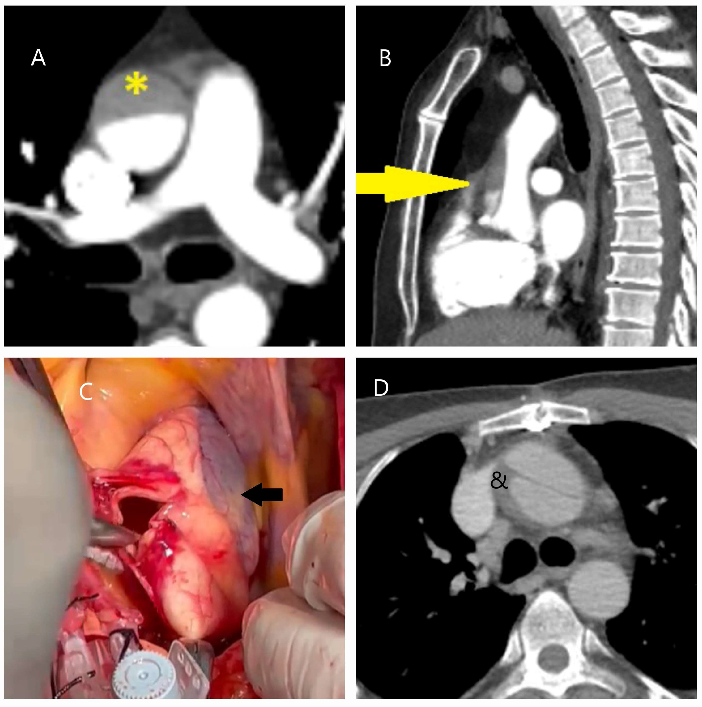 Diagnostics 15 00183 g002