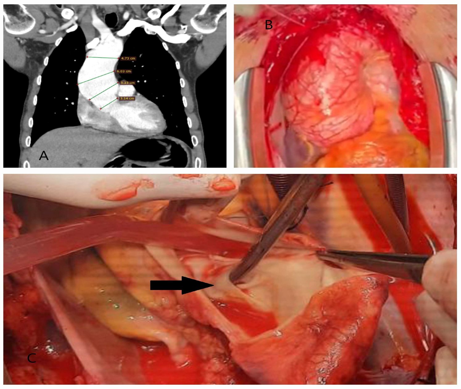 Diagnostics 15 00183 g005