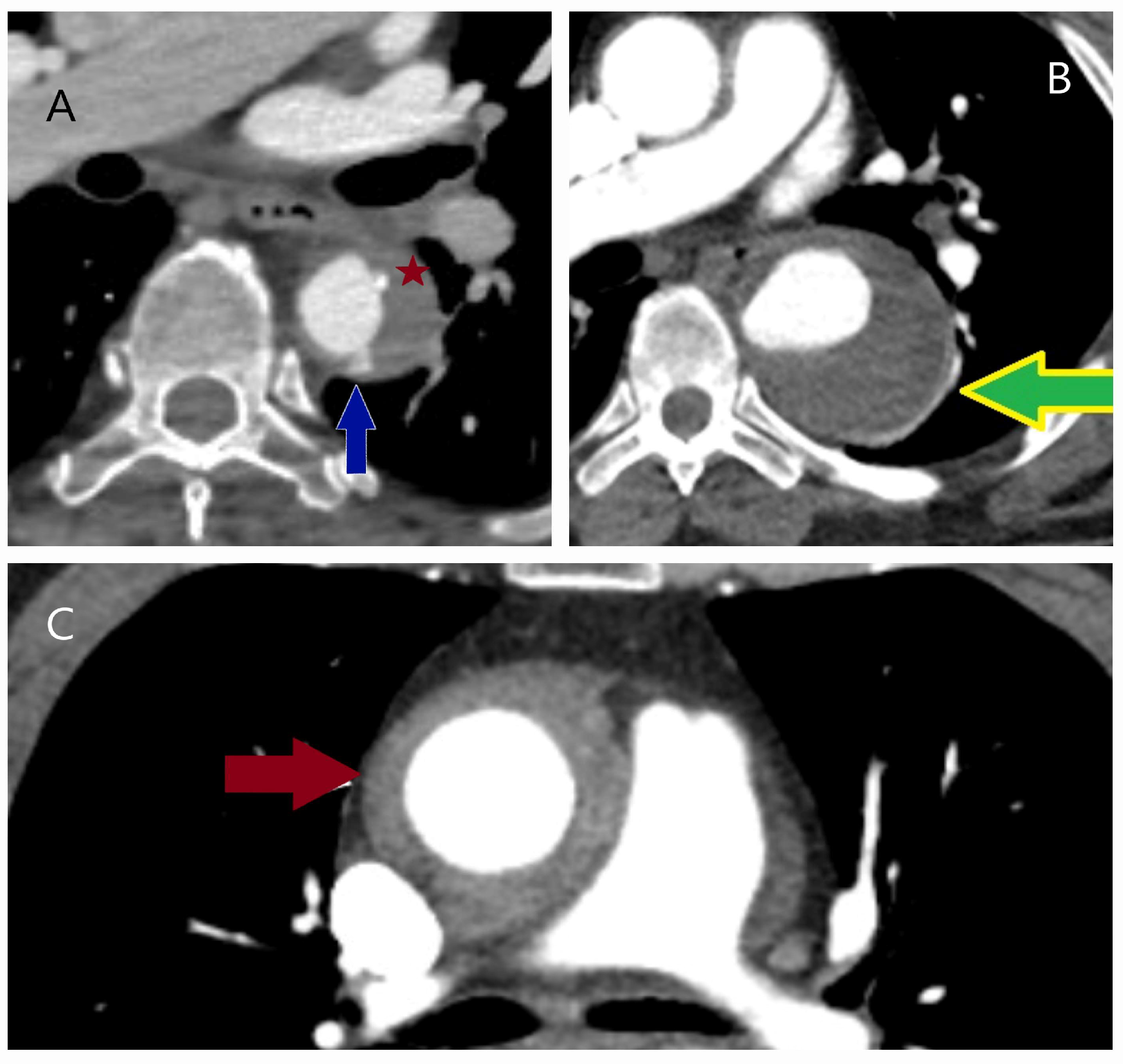 Diagnostics 15 00183 g006