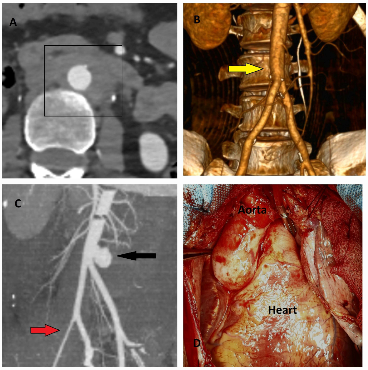 Diagnostics 15 00183 g011
