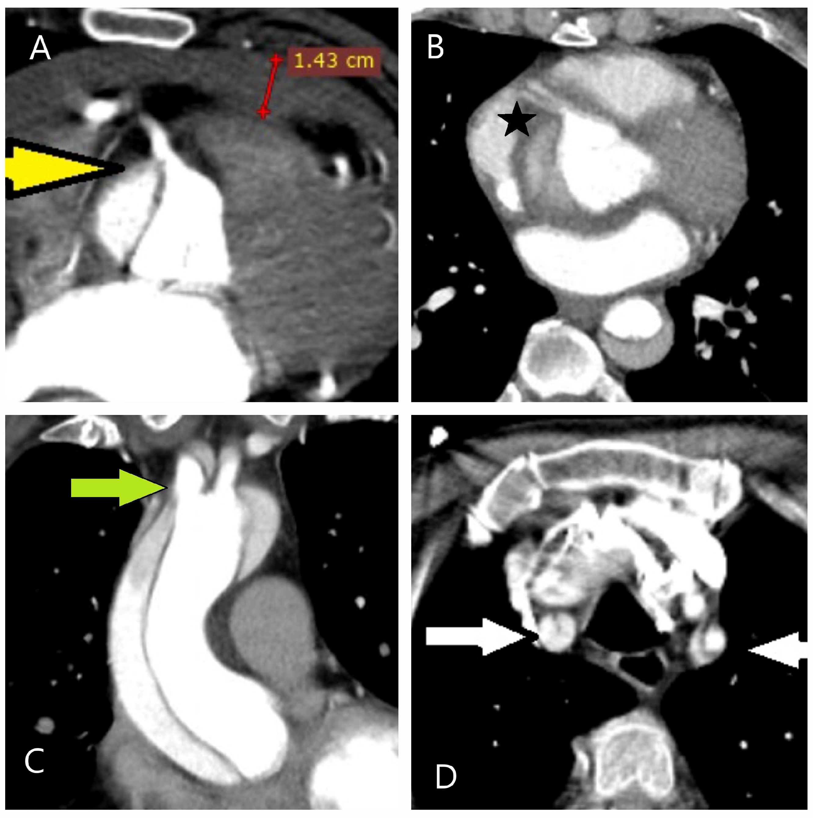 Diagnostics 15 00183 g012