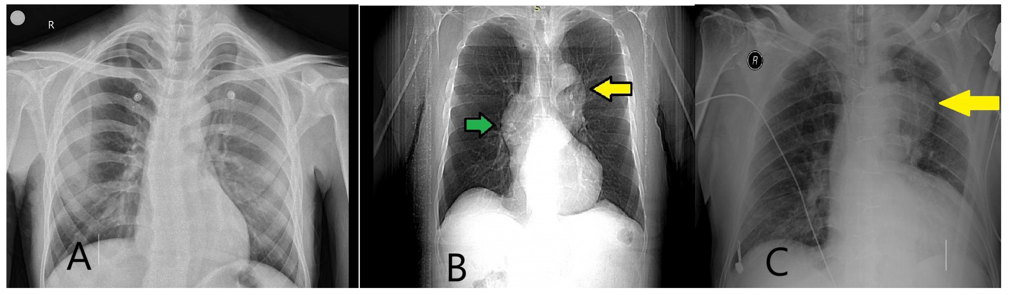 Diagnostics 15 00183 g013