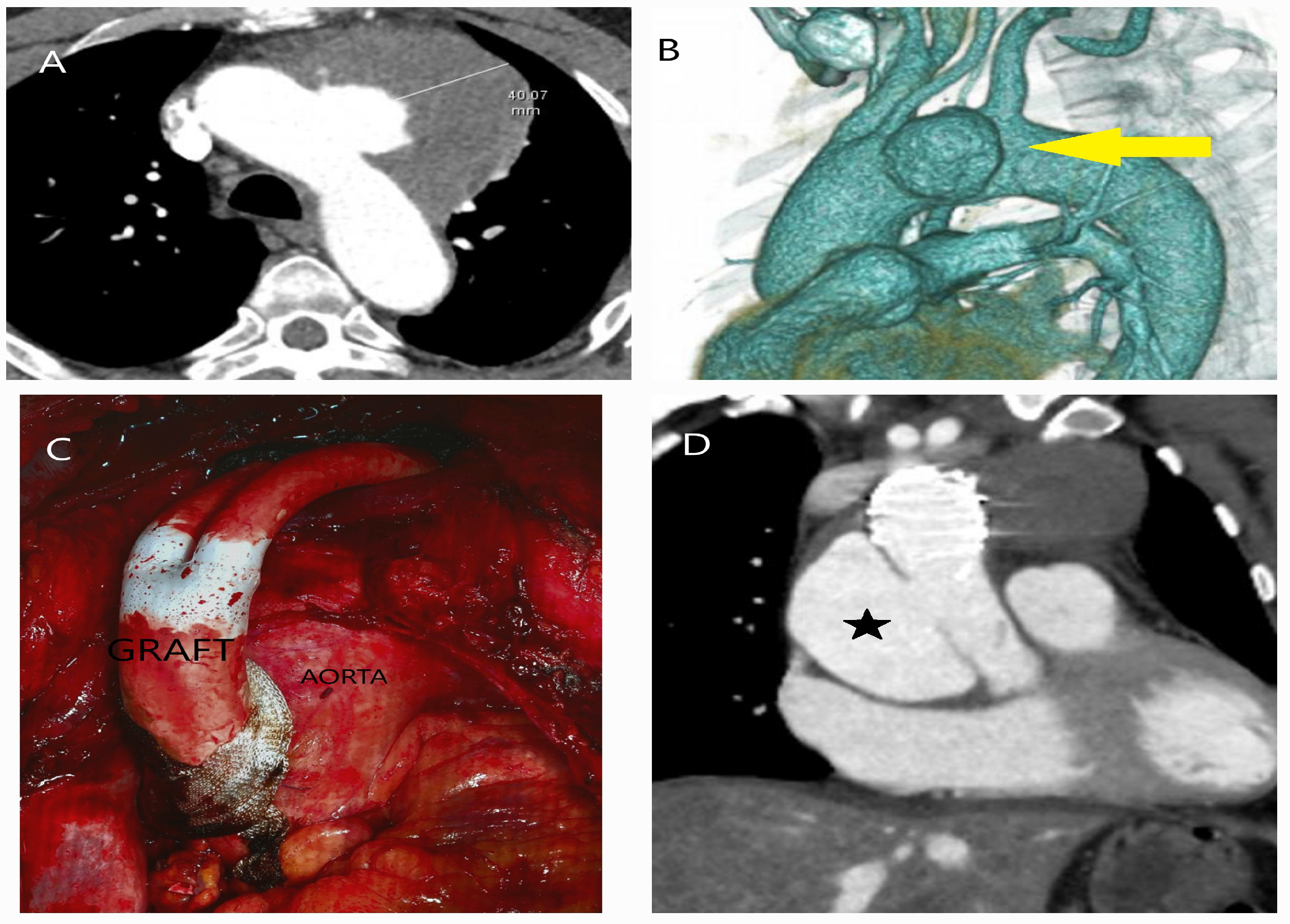 Diagnostics 15 00183 g015