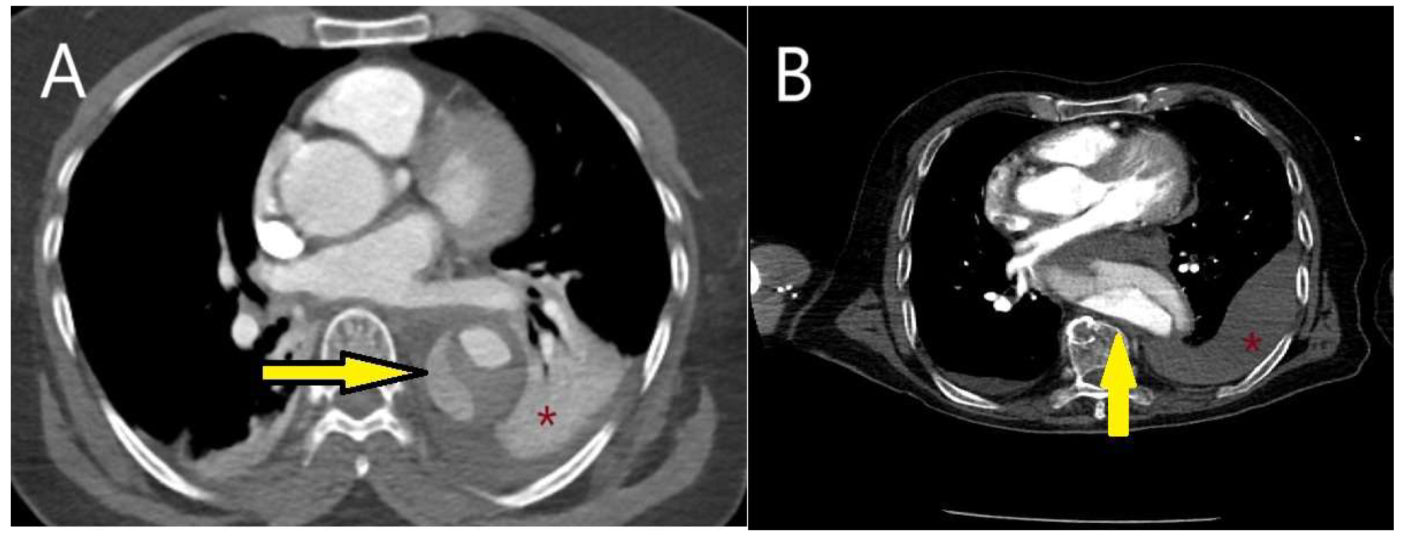 Diagnostics 15 00183 g016