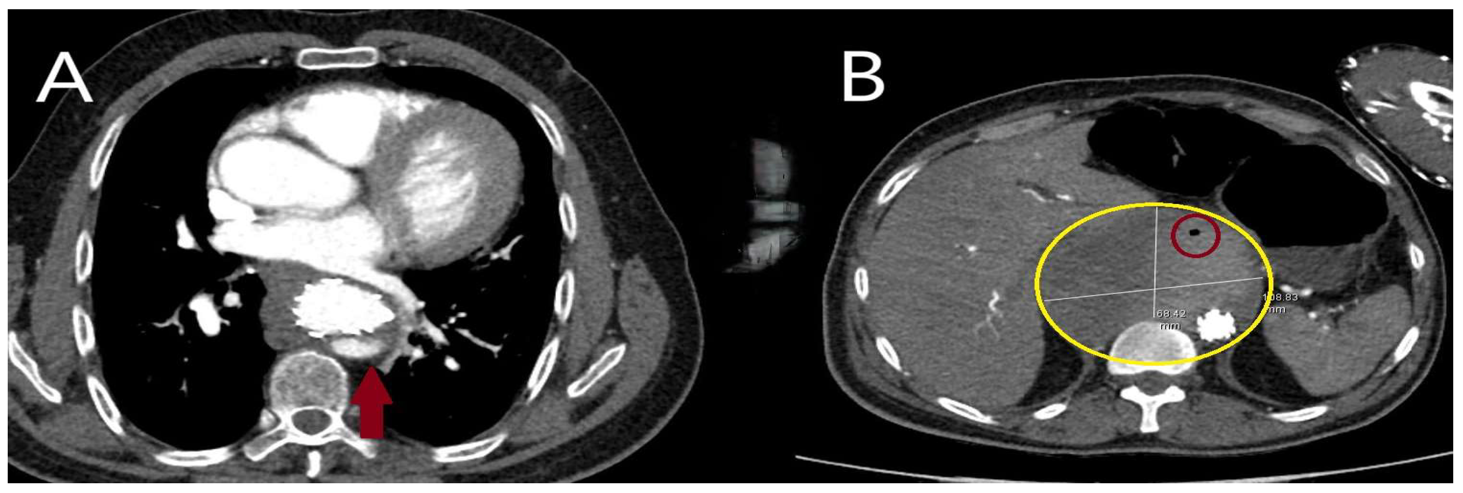 Diagnostics 15 00183 g017