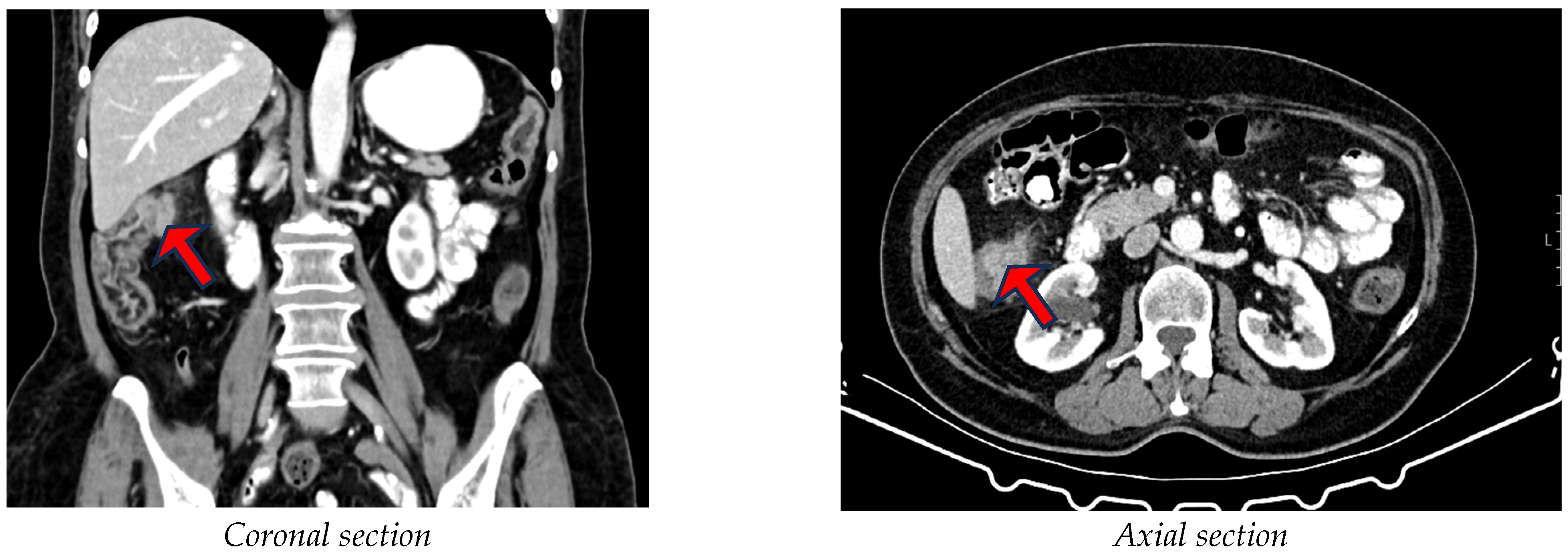 Diagnostics 15 00190 g001