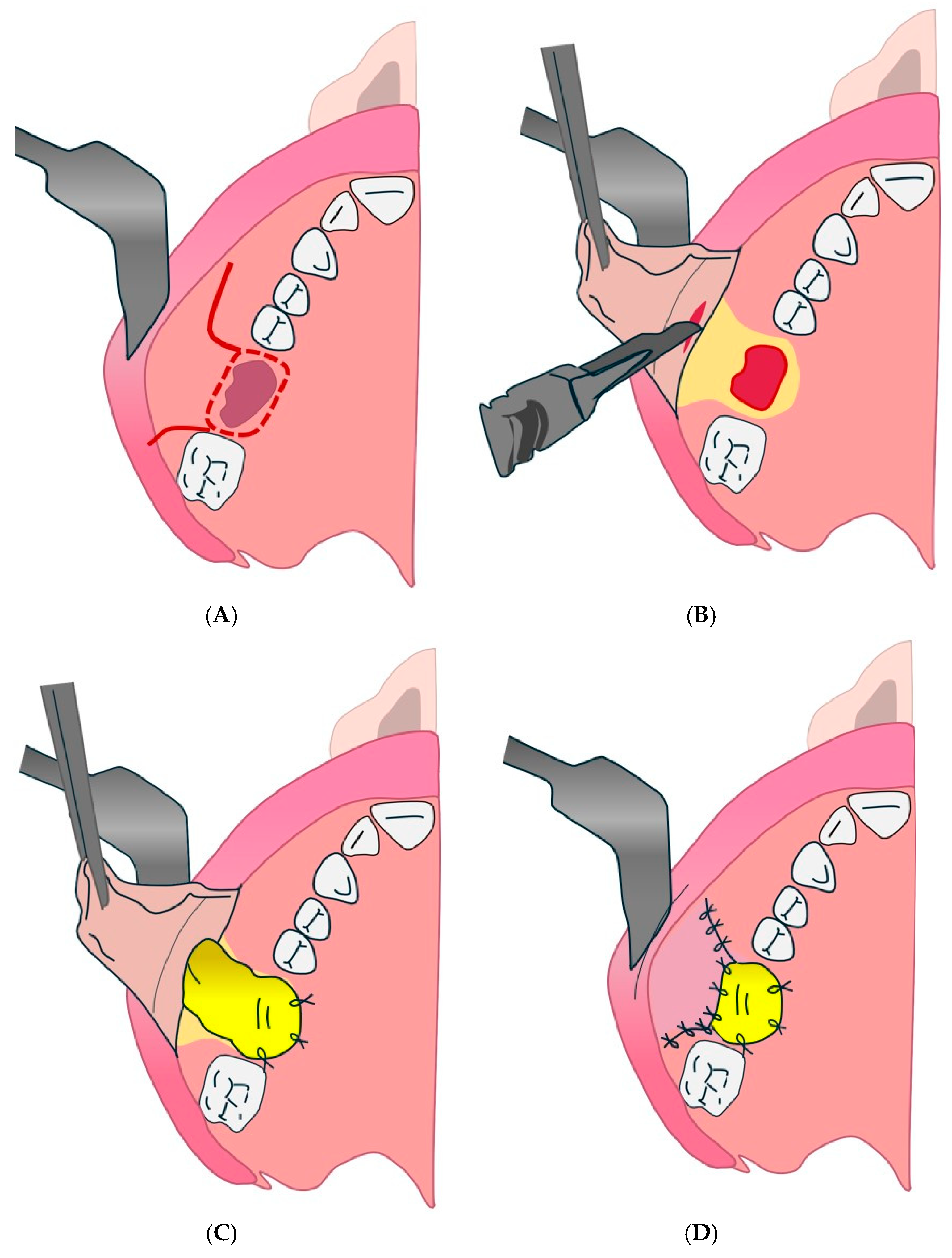 Diagnostics 15 00194 g004 Diagnostics 15 00194 g004