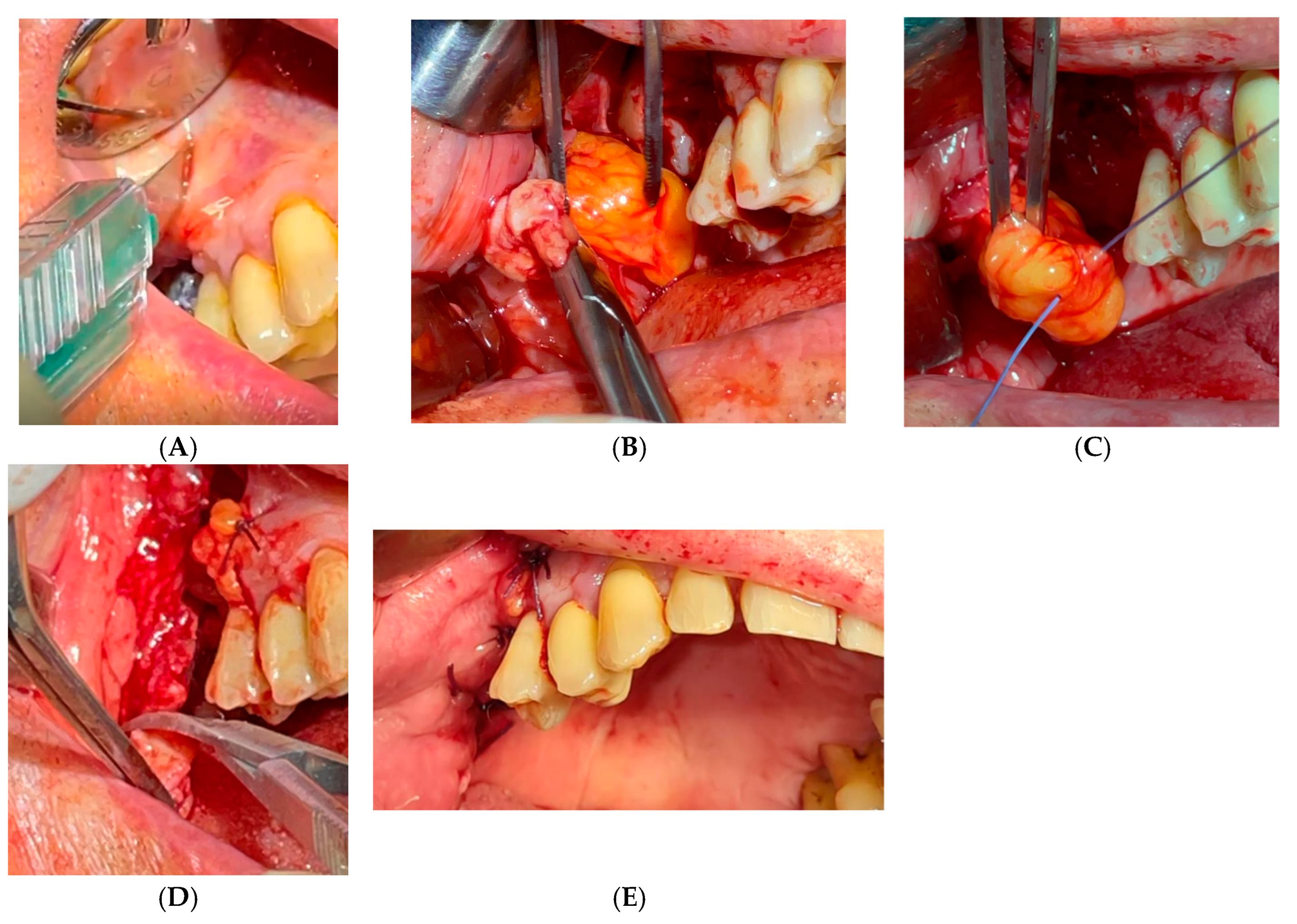 Diagnostics 15 00194 g005 Diagnostics 15 00194 g005