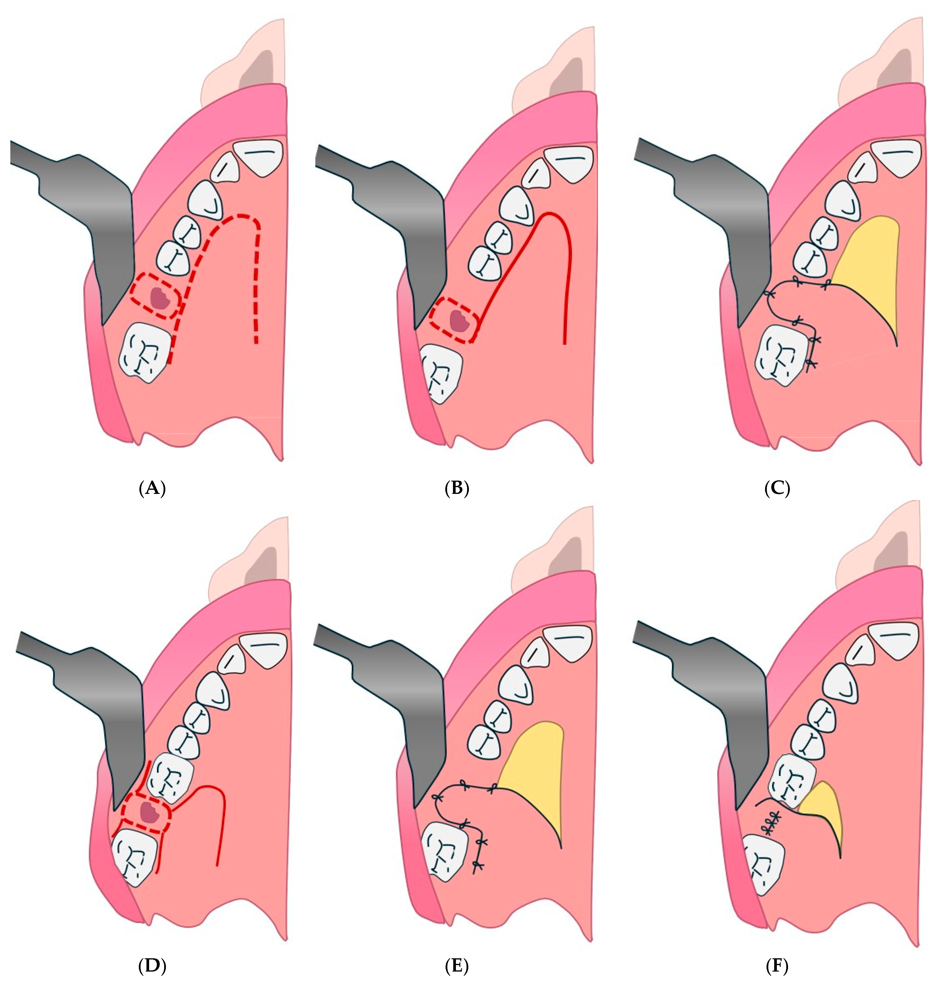 Diagnostics 15 00194 g006 Diagnostics 15 00194 g006