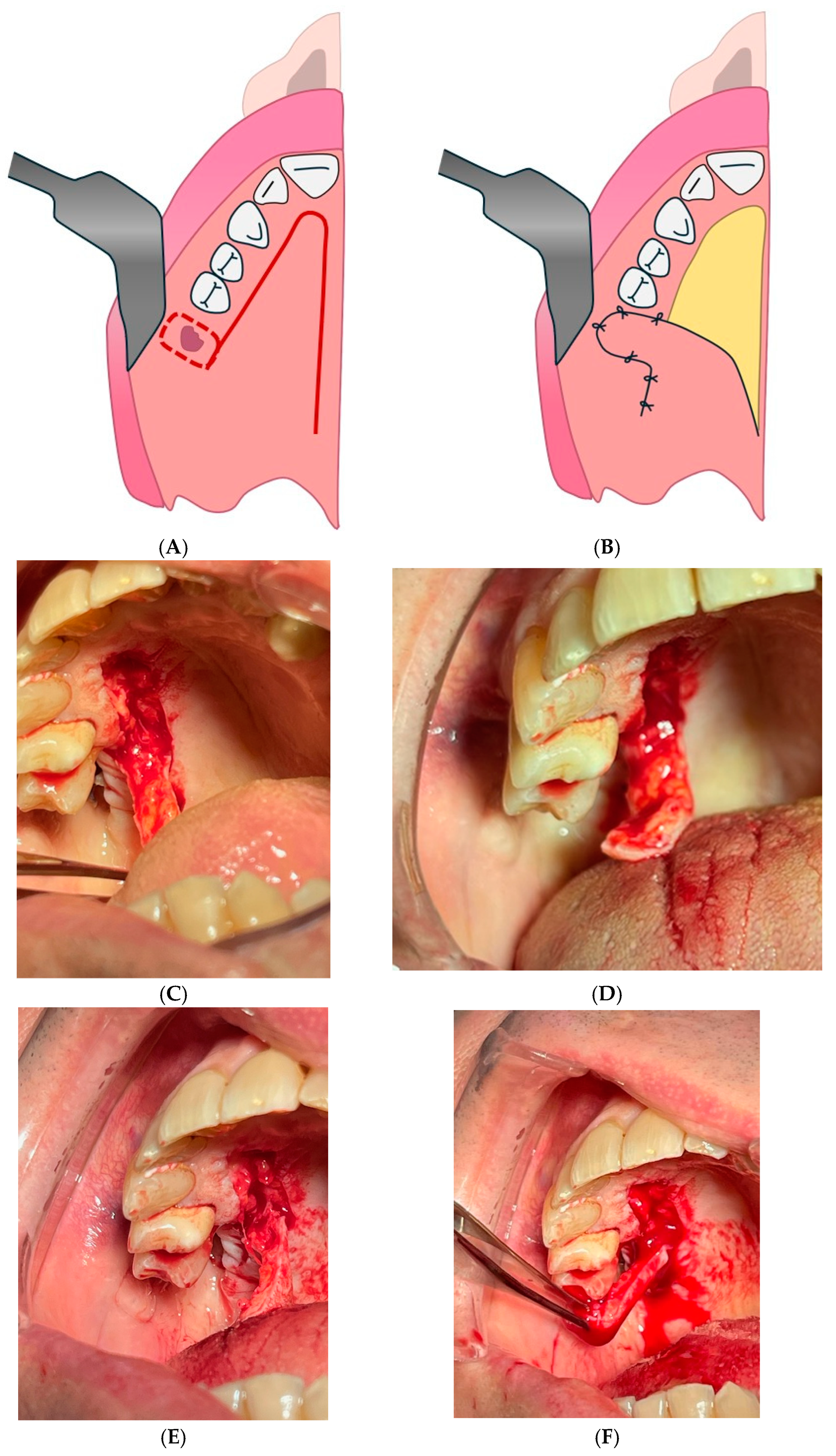Diagnostics 15 00194 g008 Diagnostics 15 00194 g008