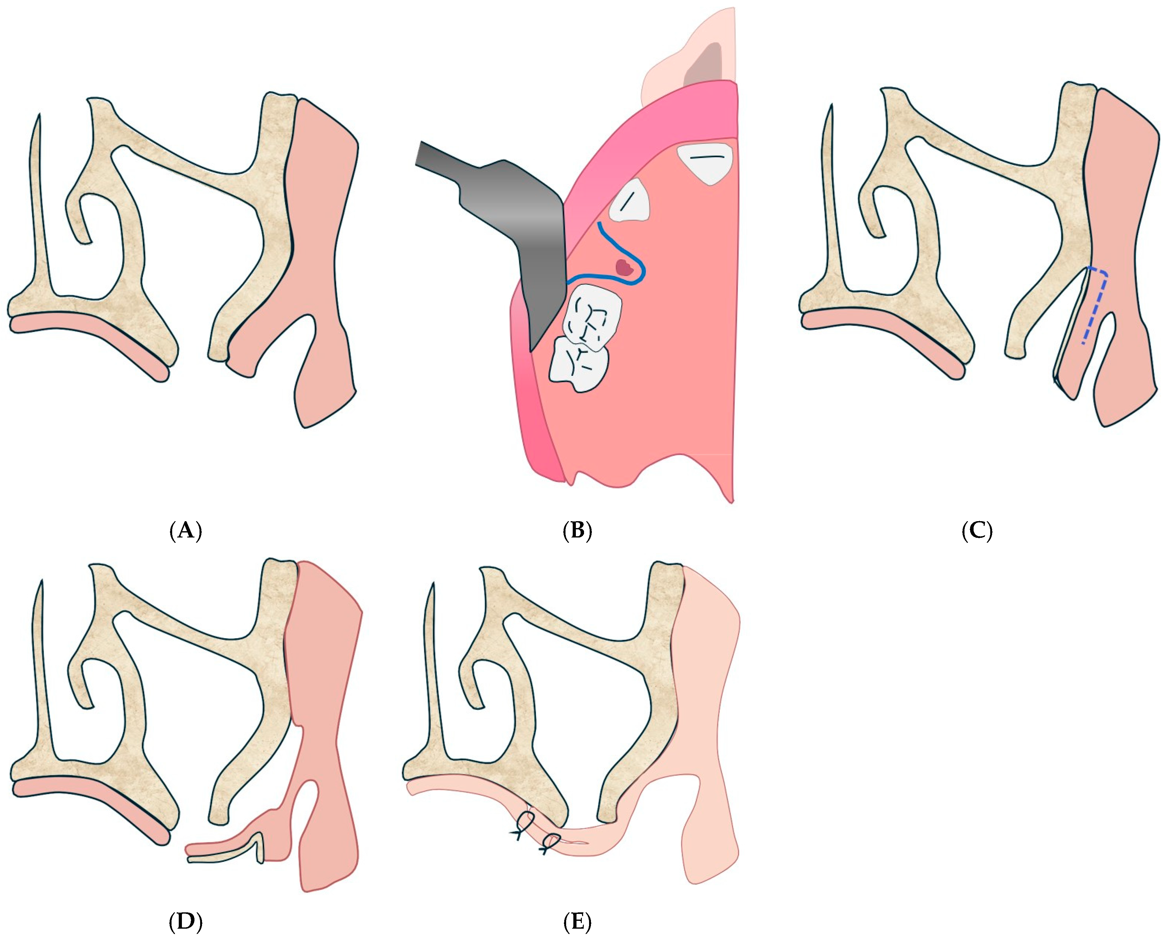 Diagnostics 15 00194 g010 Diagnostics 15 00194 g010
