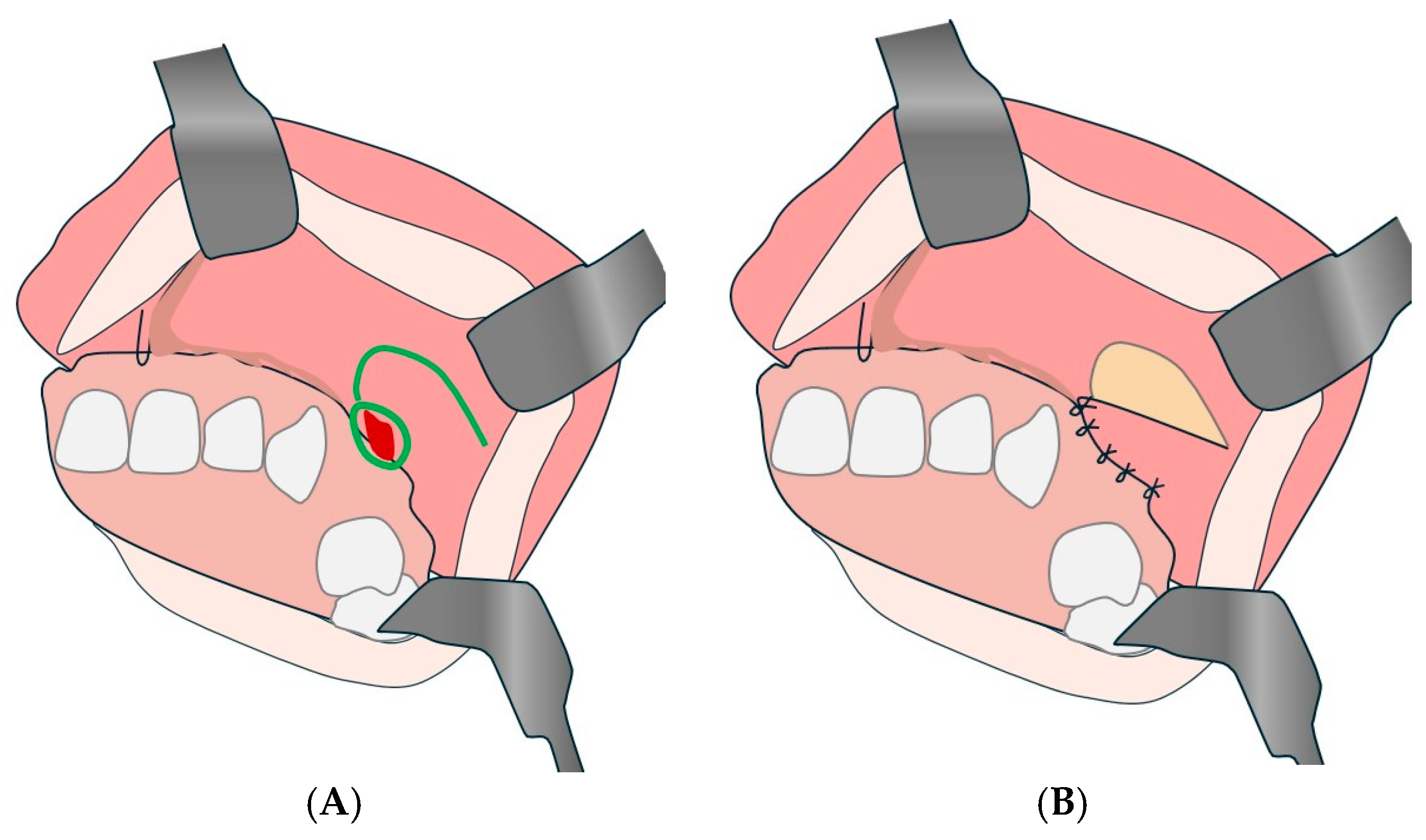 Diagnostics 15 00194 g011 Diagnostics 15 00194 g011