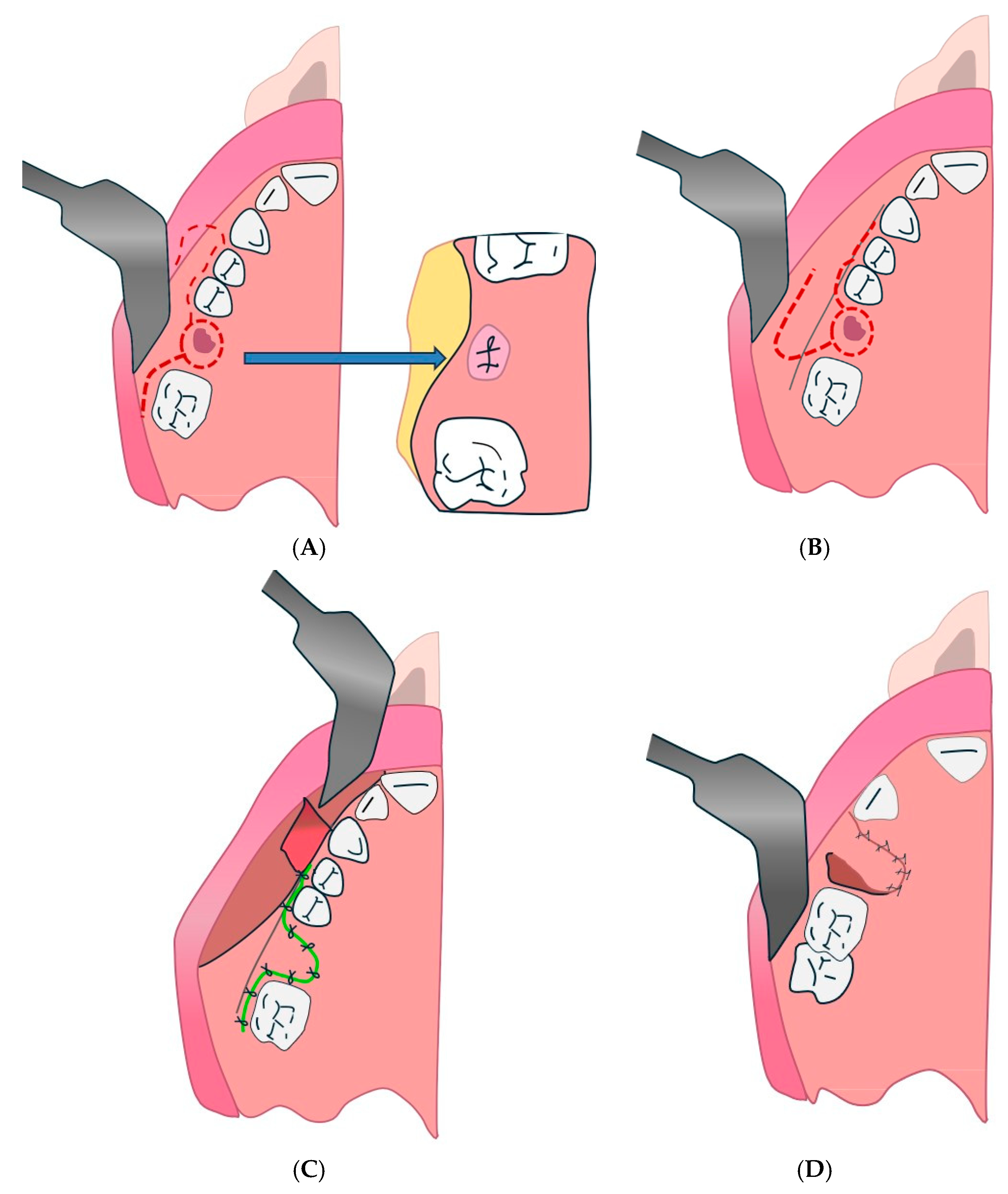 Diagnostics 15 00194 g012 Diagnostics 15 00194 g012