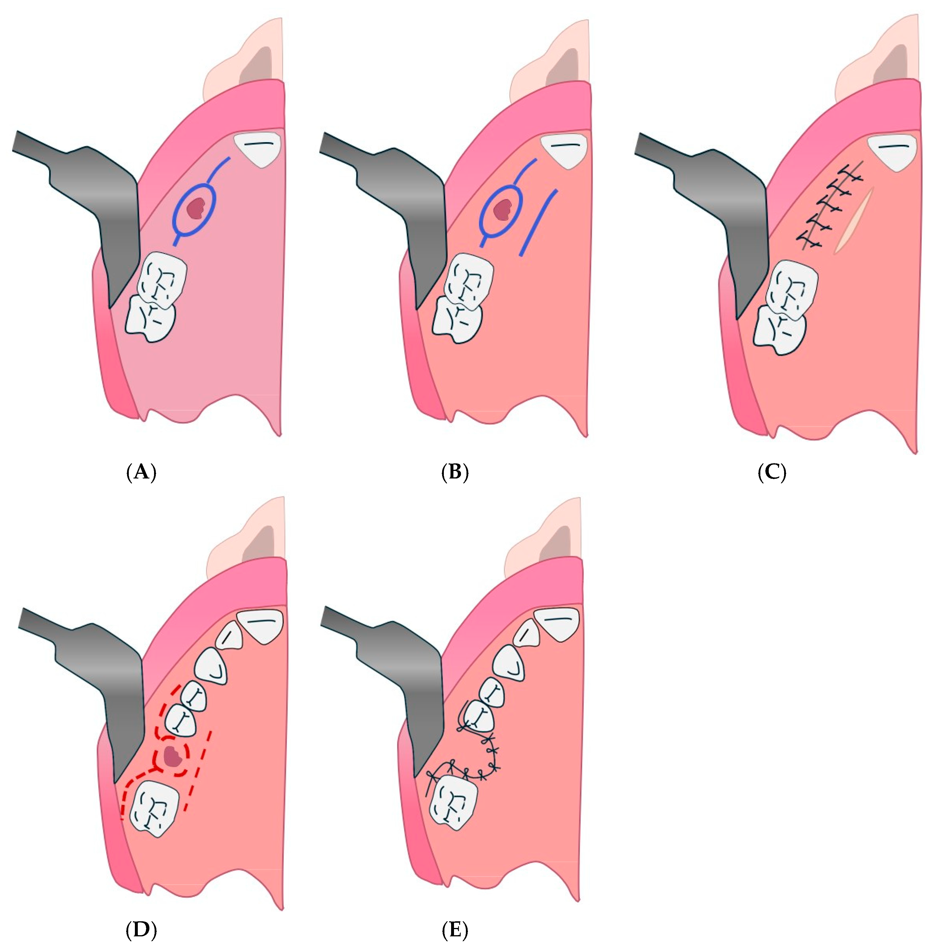 Diagnostics 15 00194 g013 Diagnostics 15 00194 g013