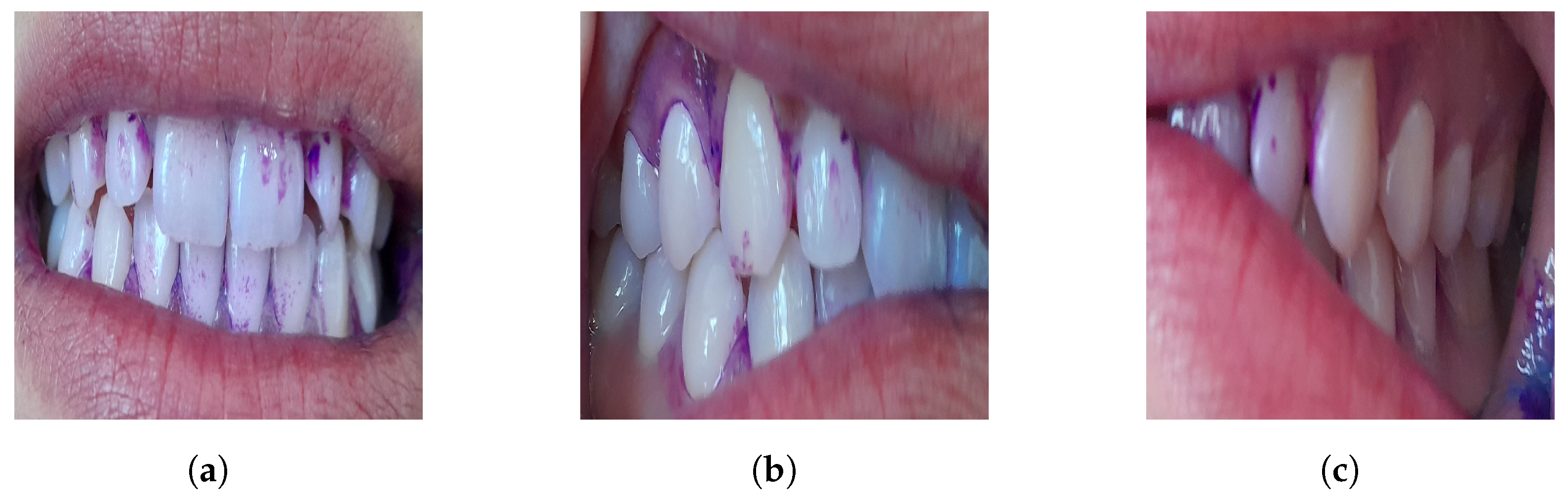 Diagnostics 15 00231 g004