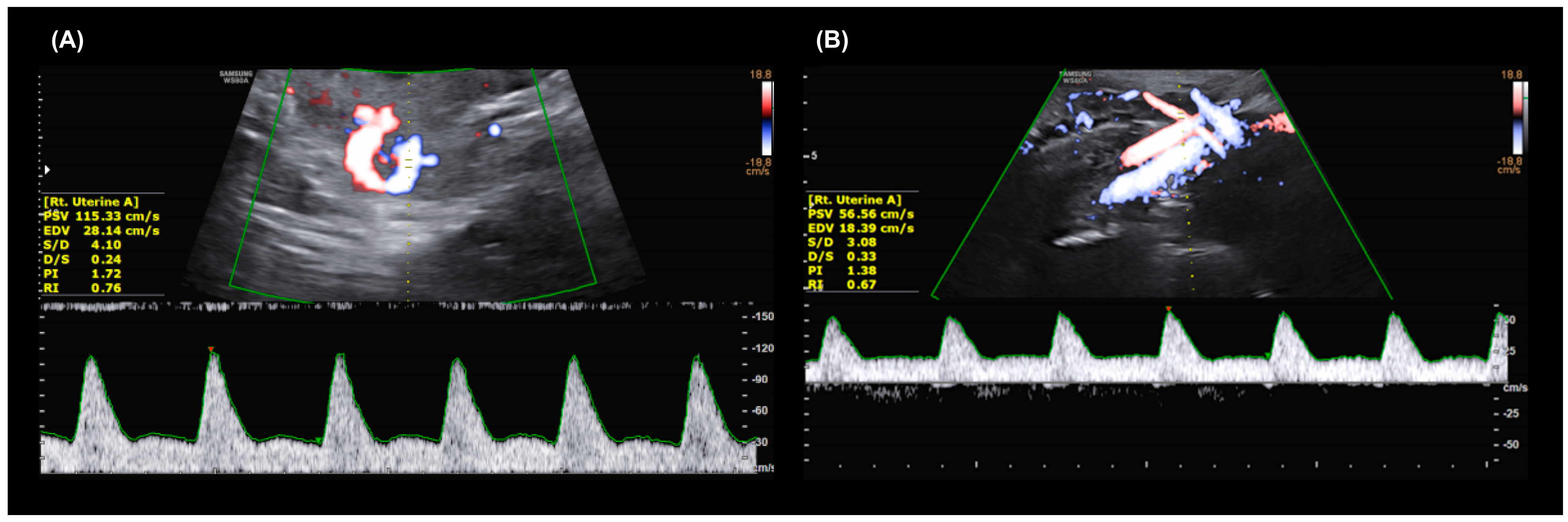 Diagnostics 15 00233 g002