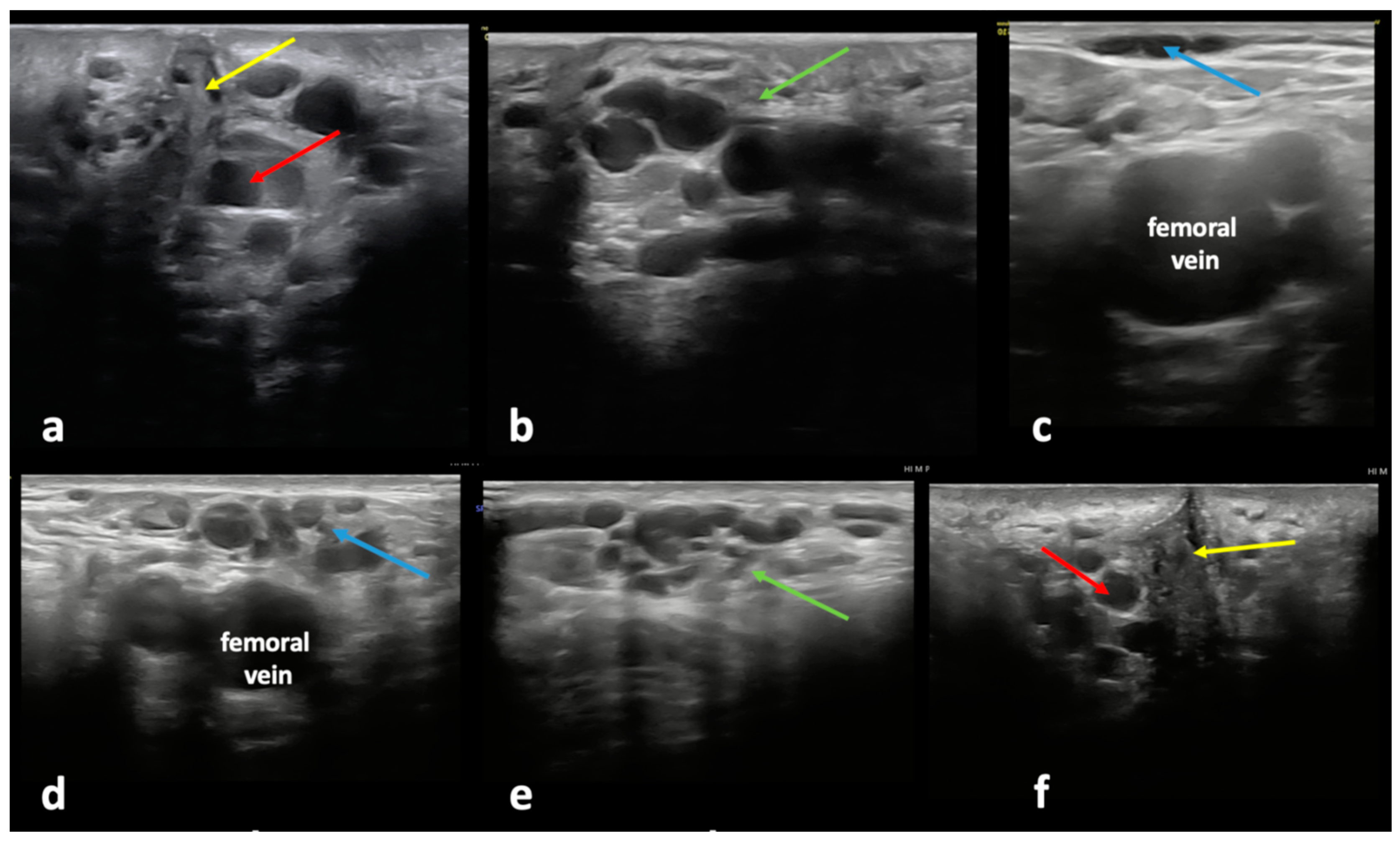 Diagnostics 15 00245 g004