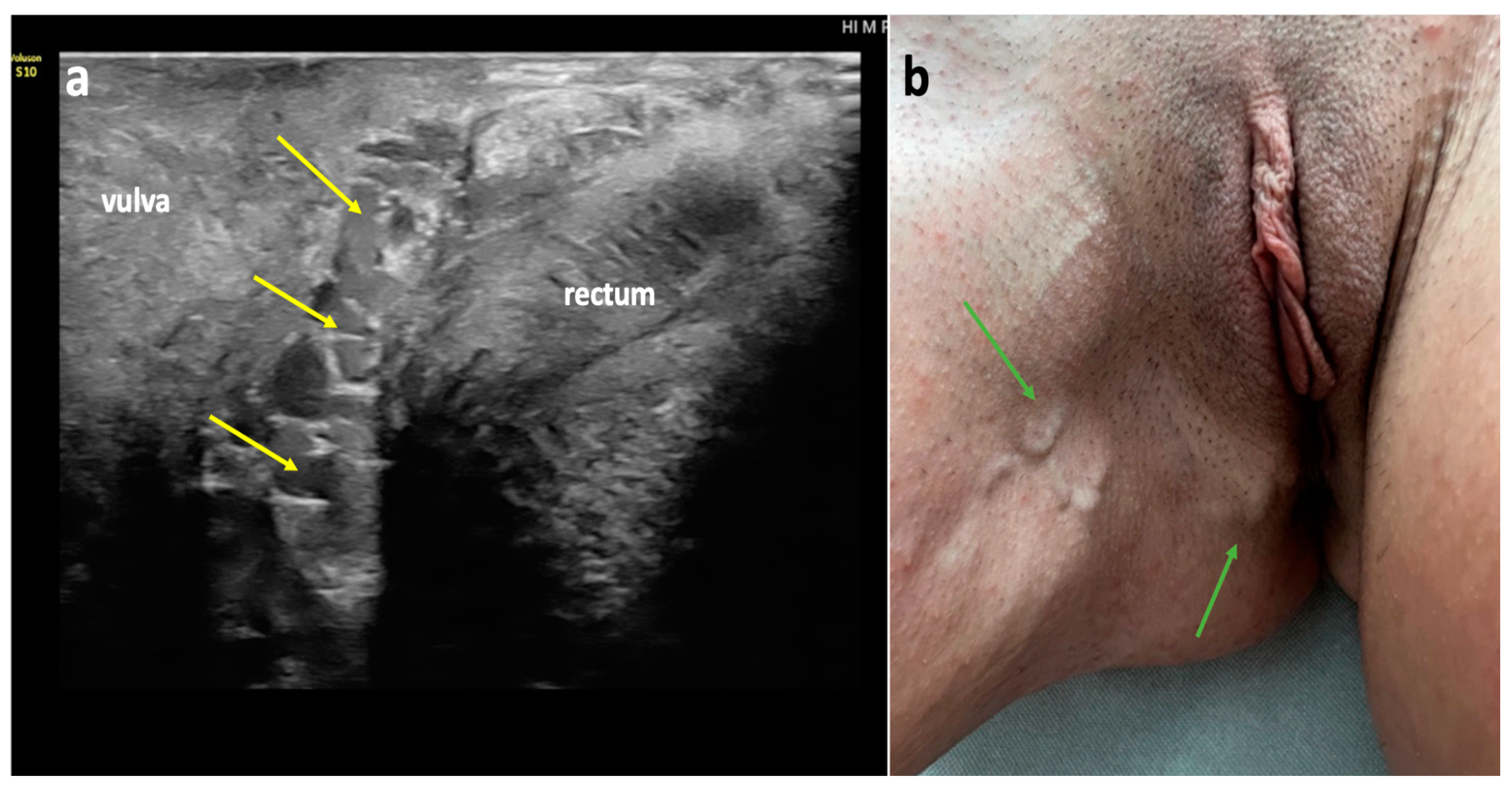 Diagnostics 15 00245 g009