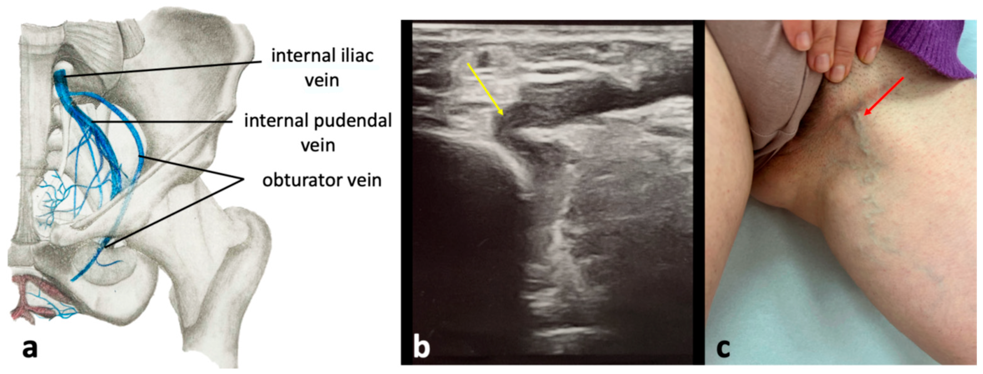 Diagnostics 15 00245 g013