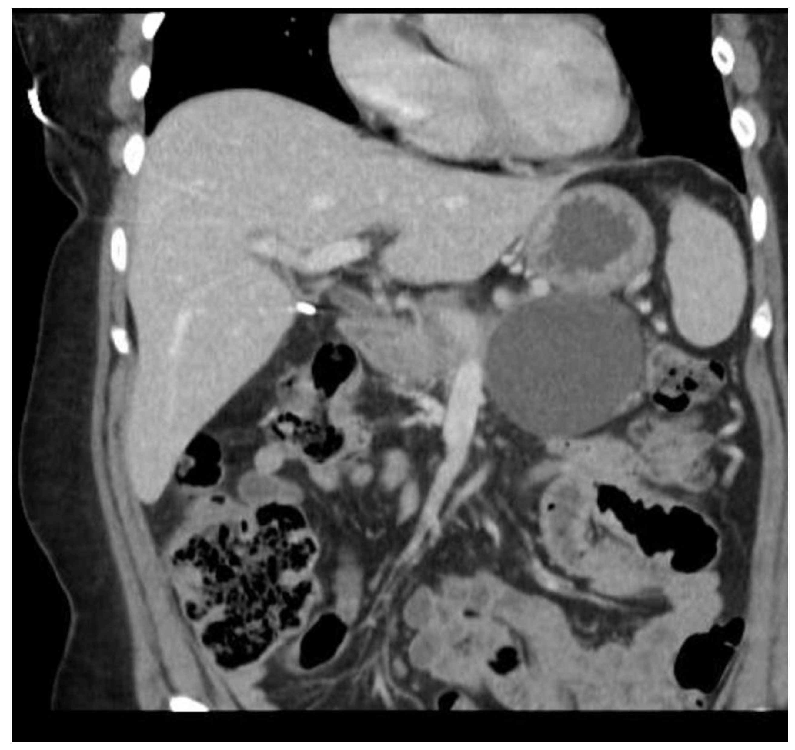 Diagnostics 15 00258 g006